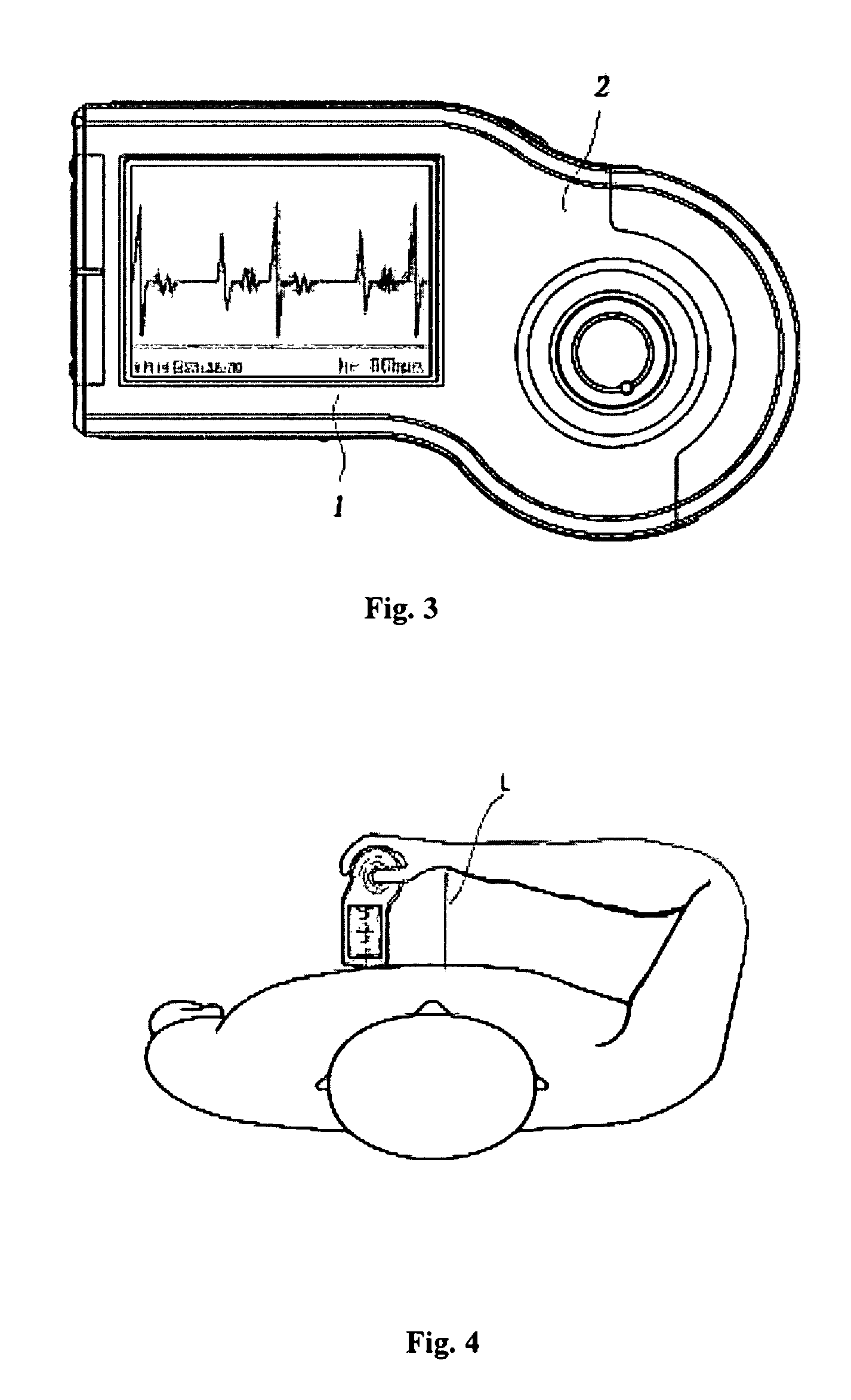 Portable electrocardiograph