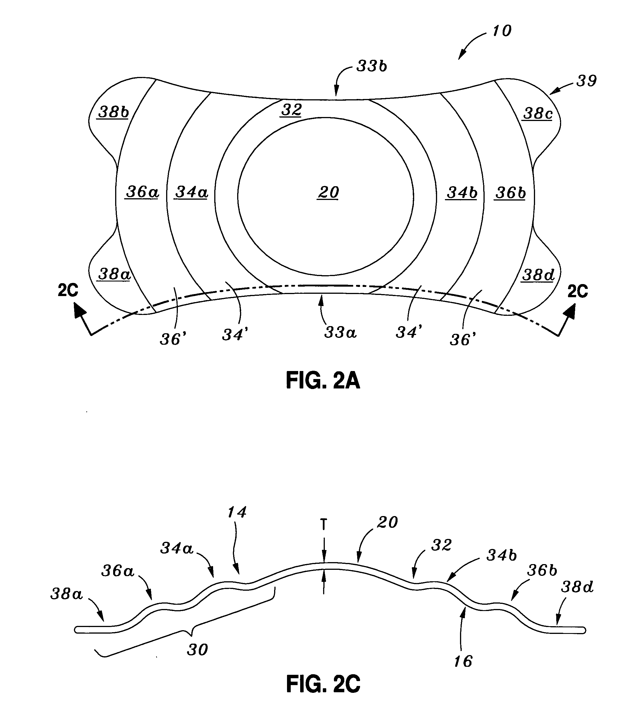 Intraocular and intracorneal refractive lenses