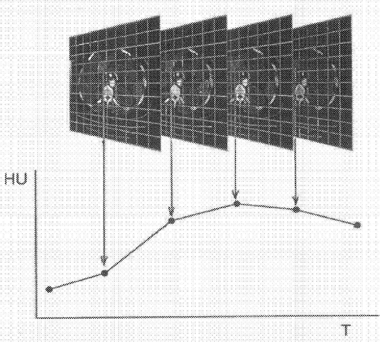 Processing of abdominal images