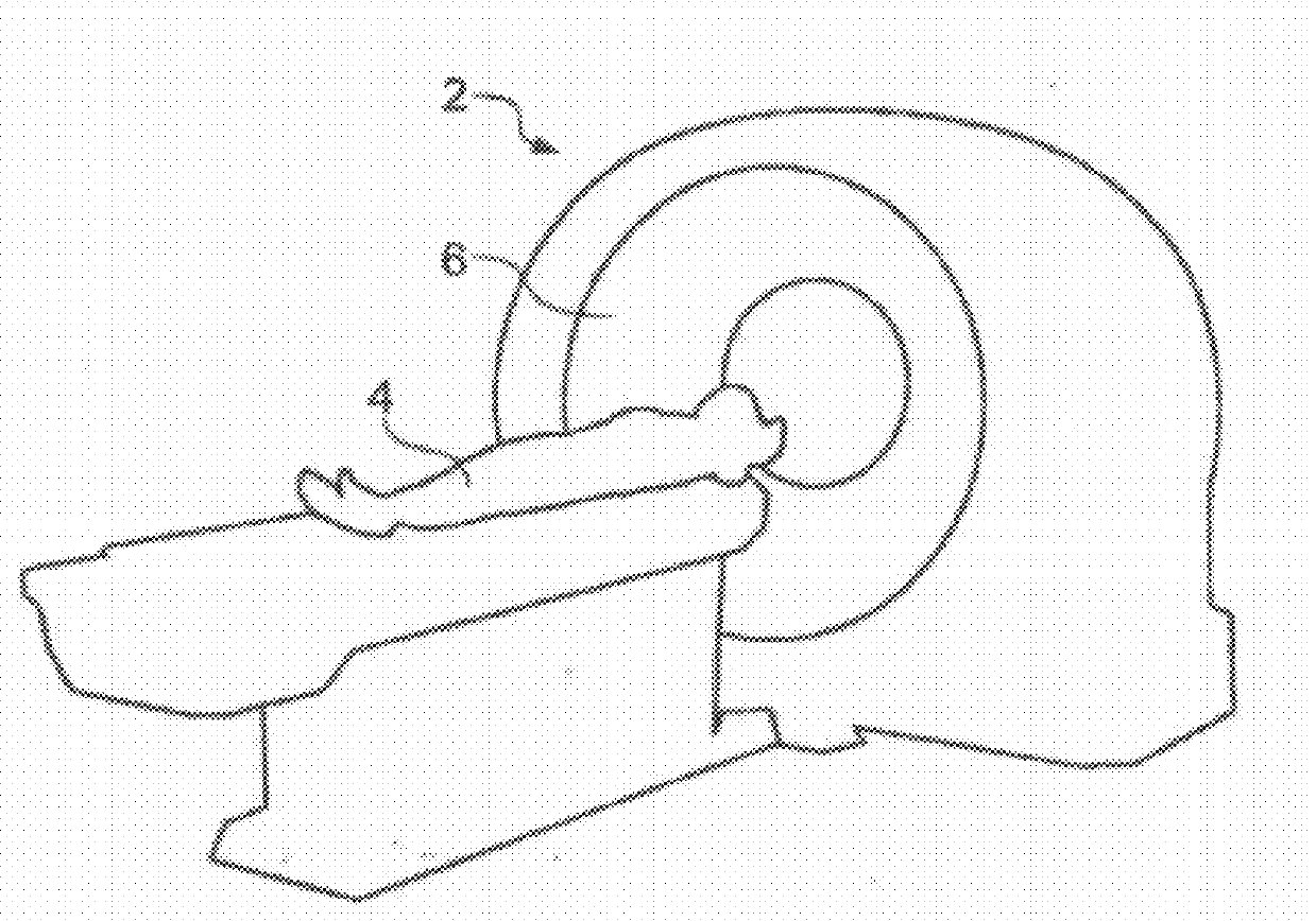 Processing of abdominal images