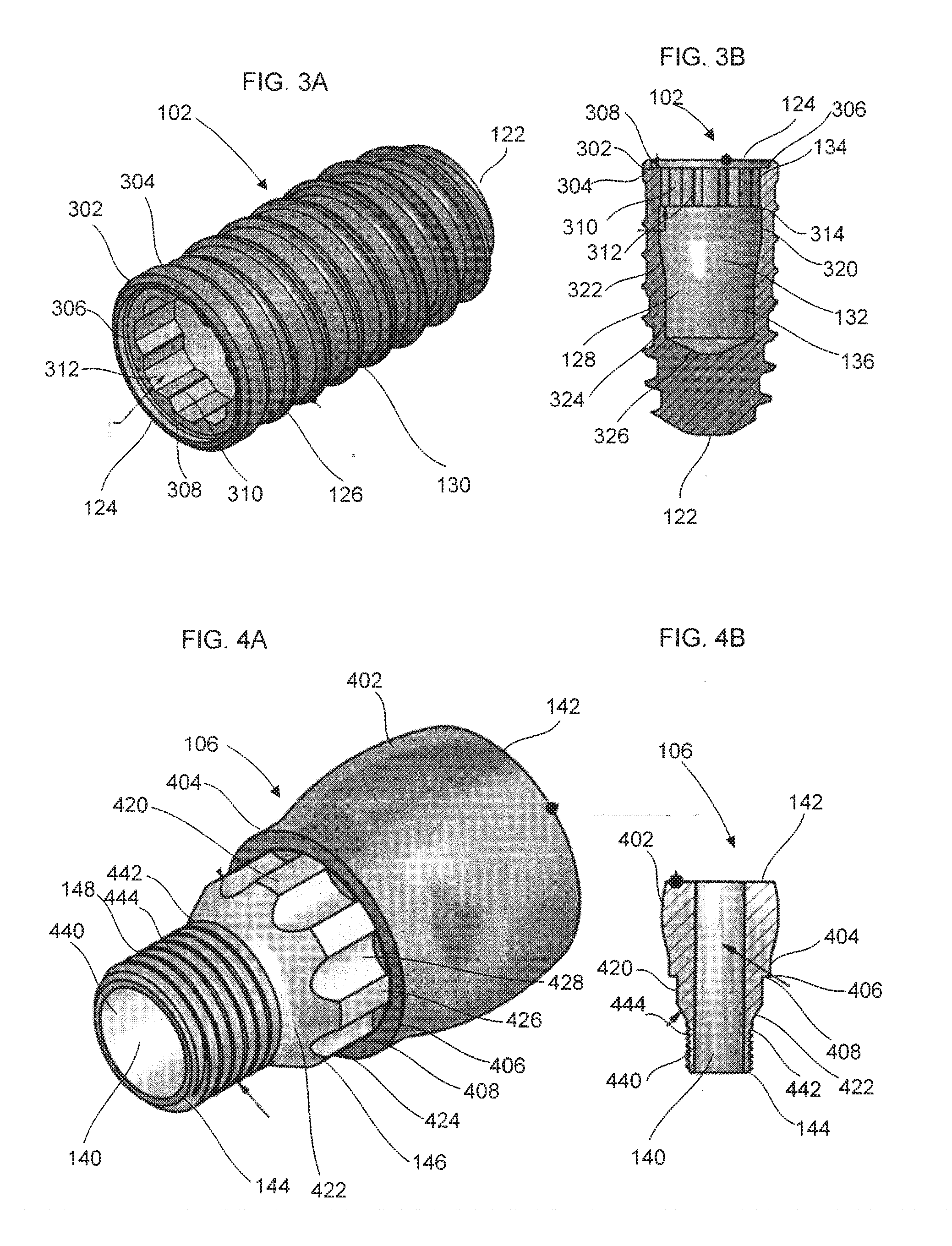 Screwless dental implant connection