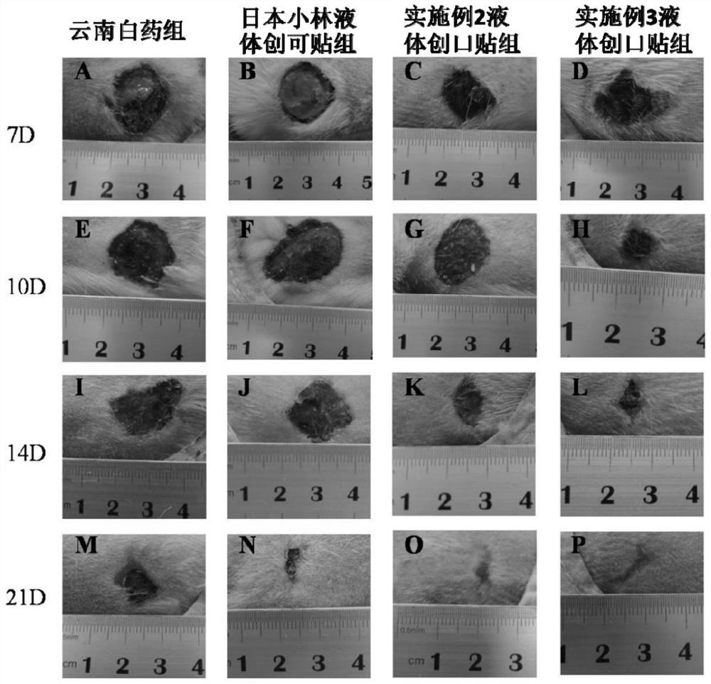 A kind of liquid bandage and preparation method thereof