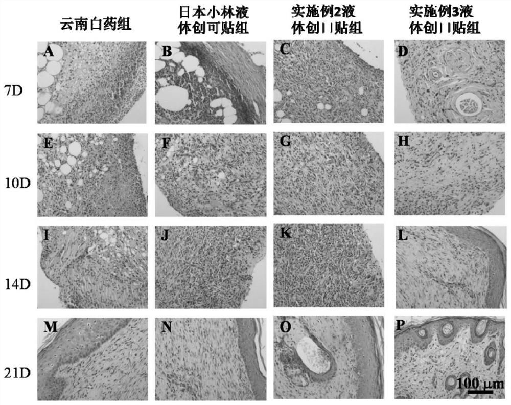 A kind of liquid bandage and preparation method thereof