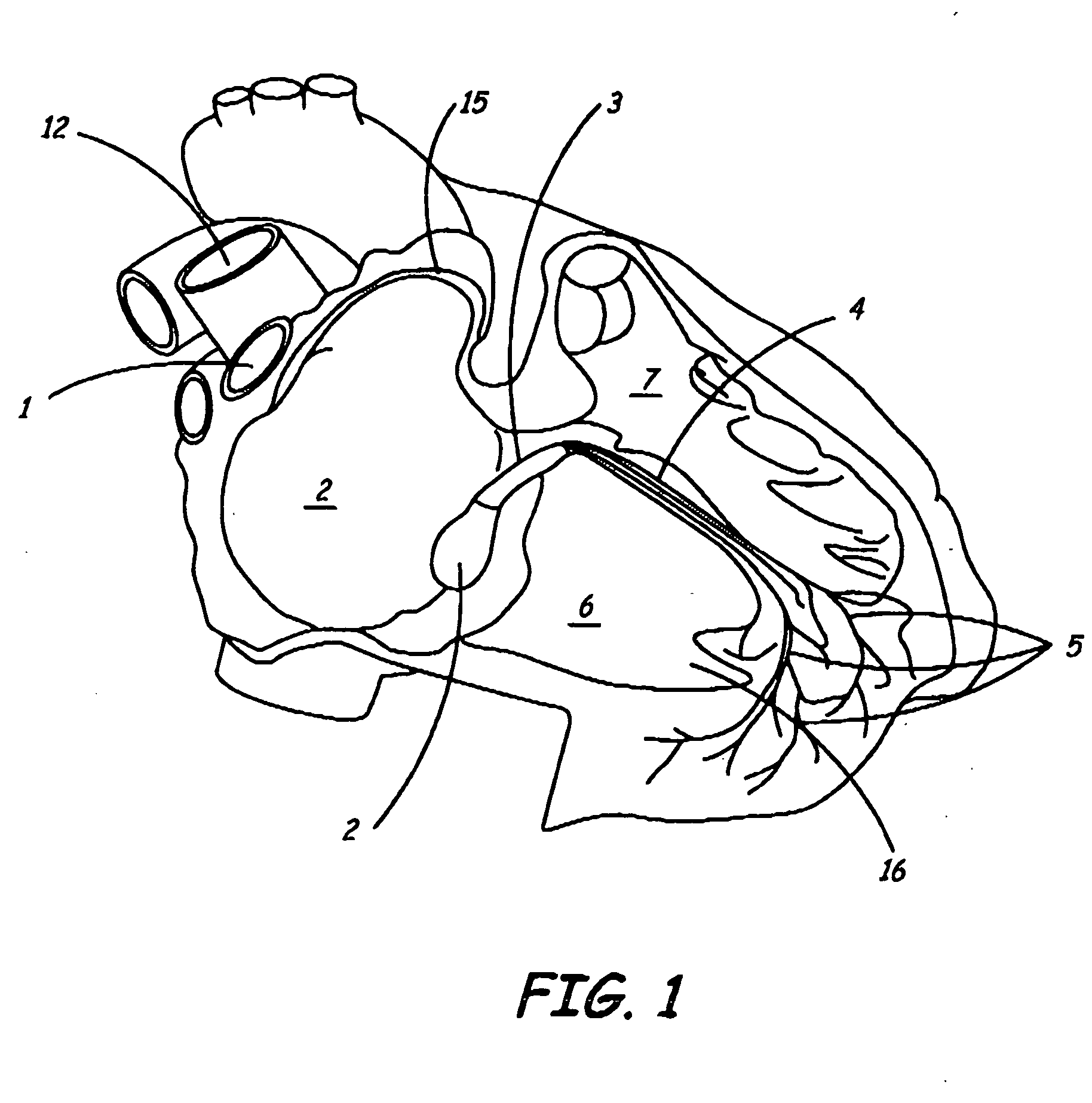 Pacing method