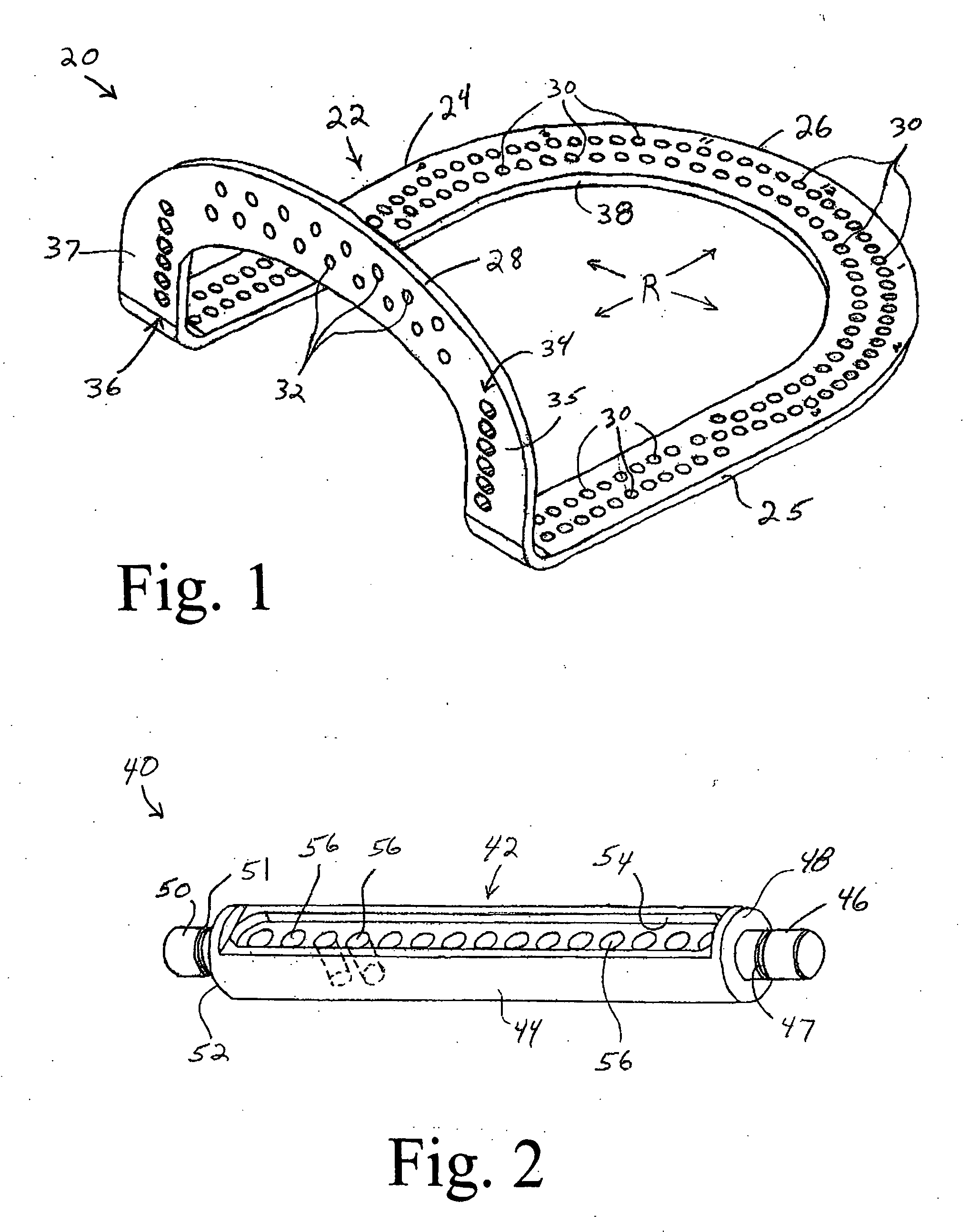 External bone/joint fixation device