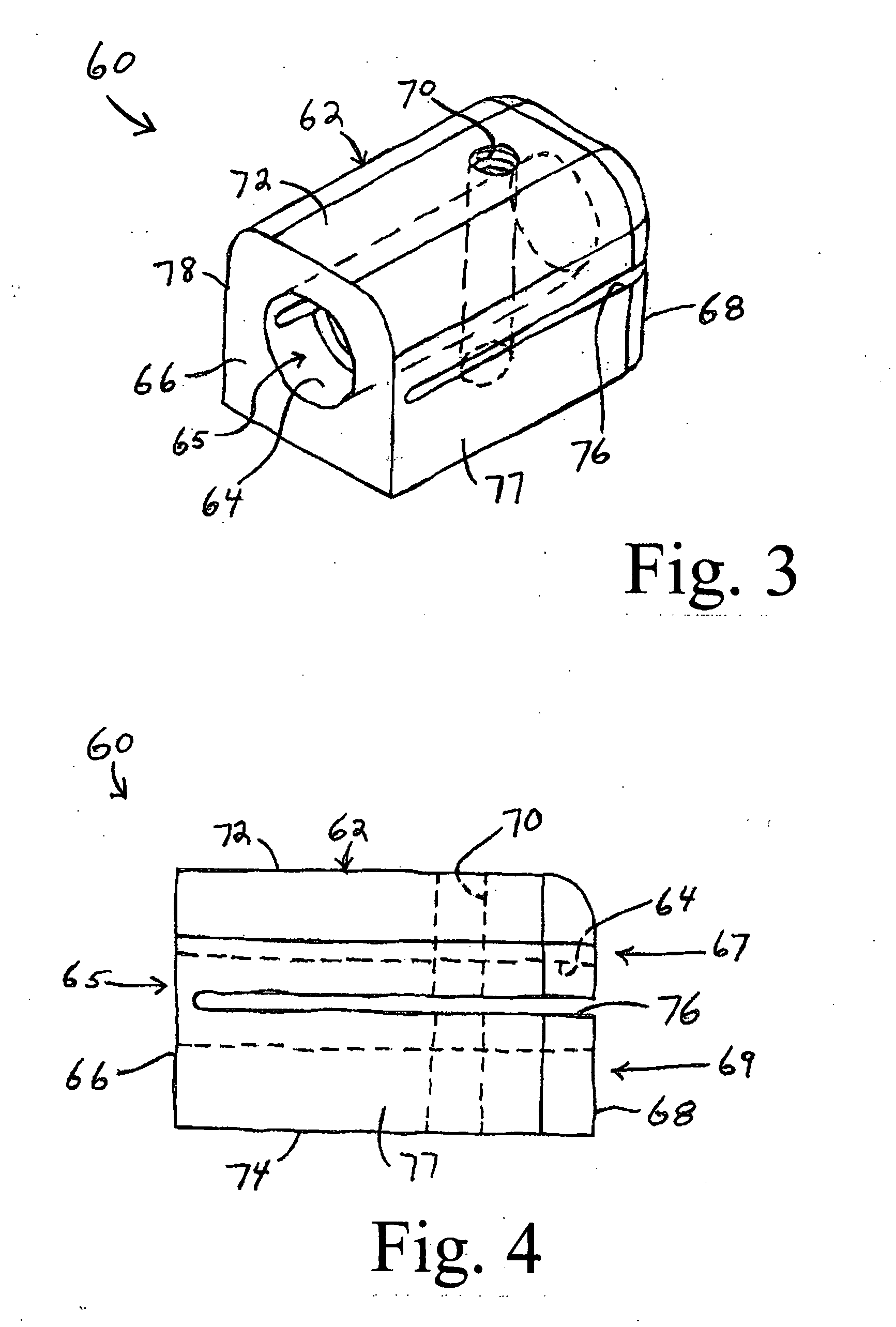 External bone/joint fixation device