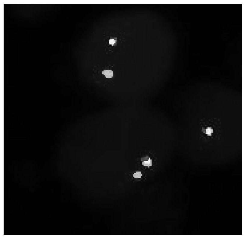 A fish probe set for detecting fgfr2 fusion and its application