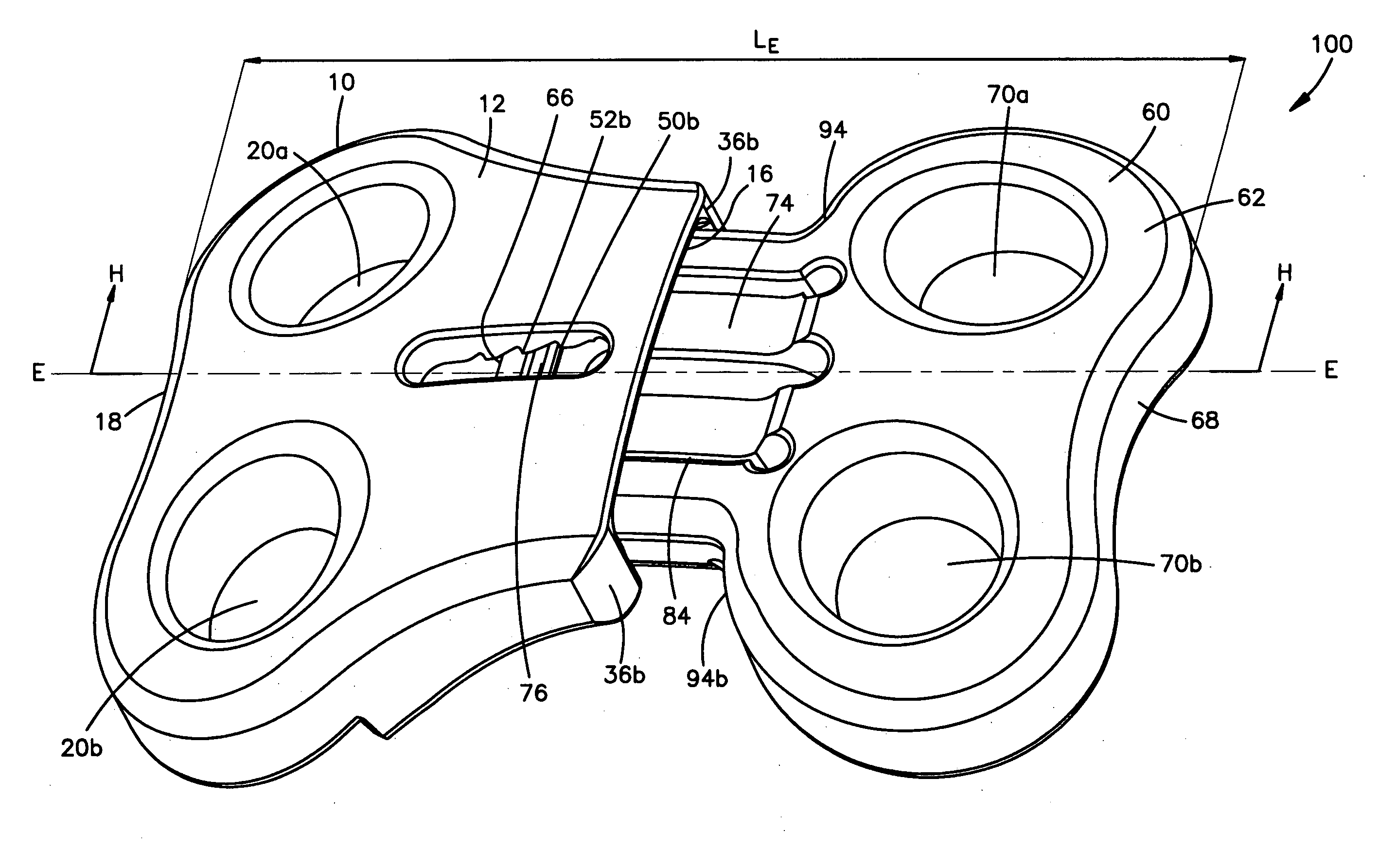 Unidirectional translation system for bone fixation