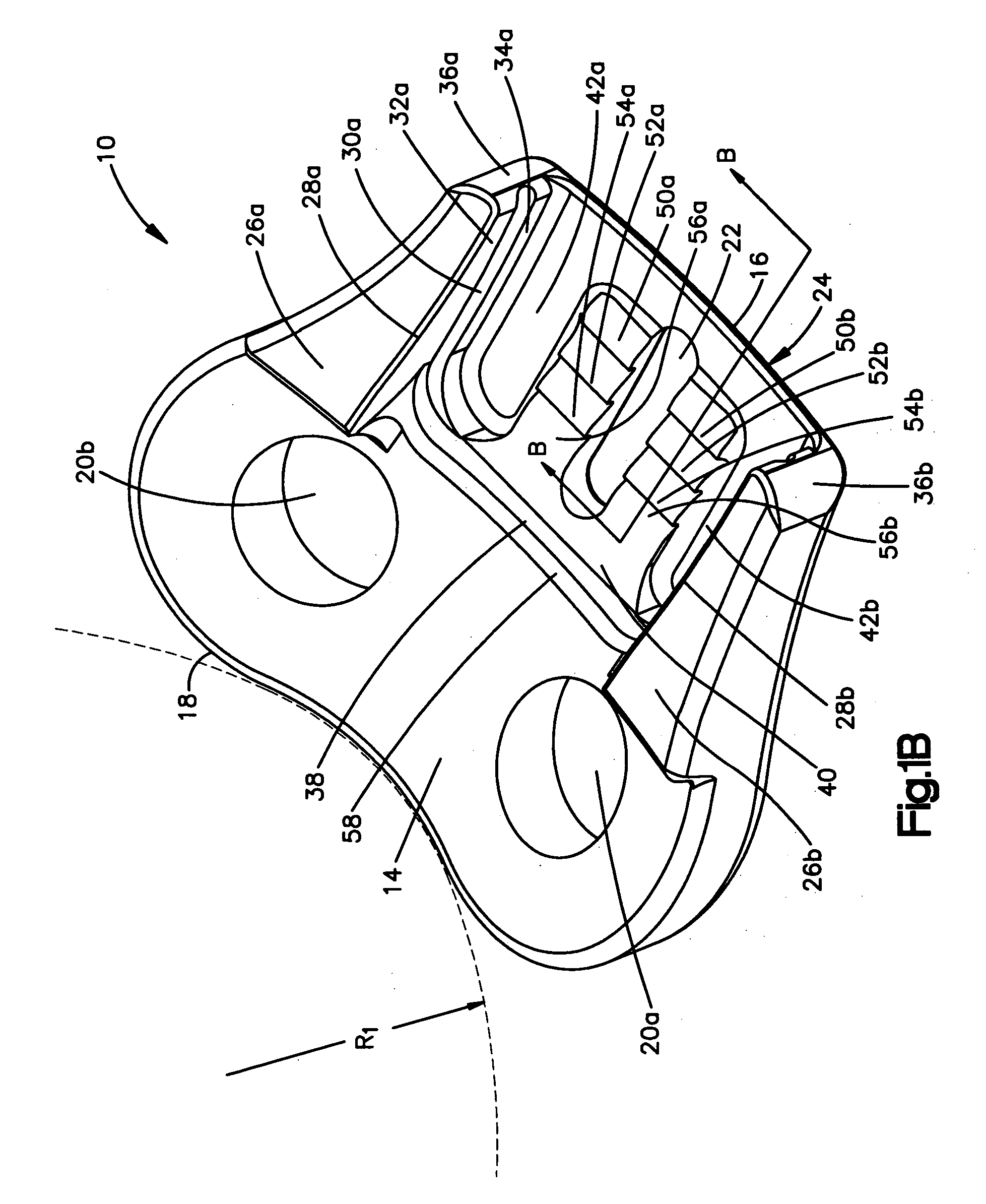 Unidirectional translation system for bone fixation