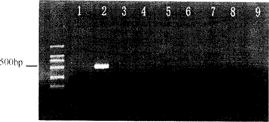 Wheat stripe rust bacteria molecalar detecting method