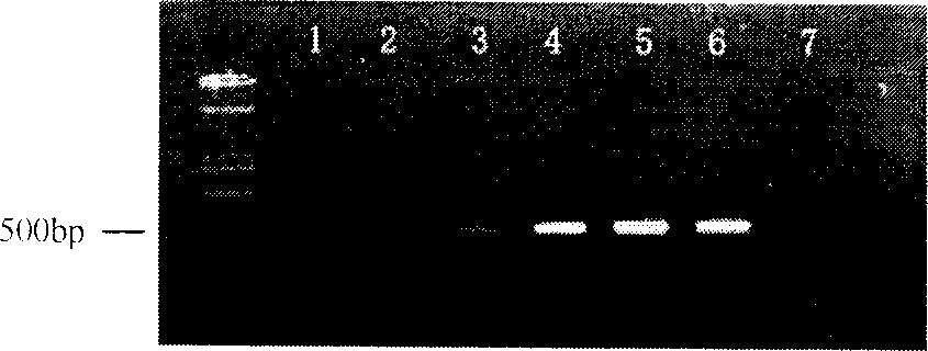 Wheat stripe rust bacteria molecalar detecting method