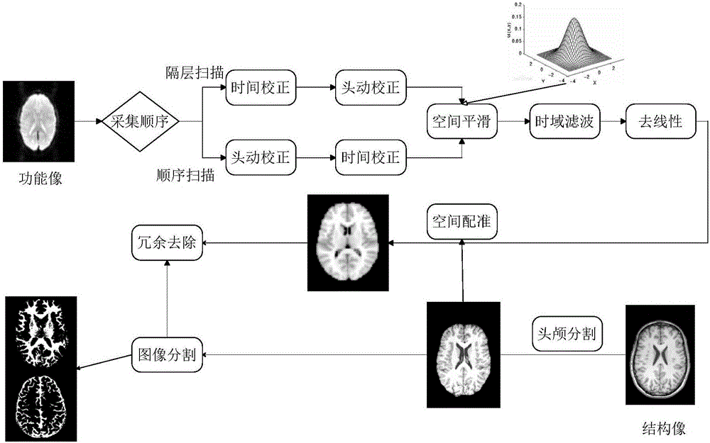 FMRI and DTI fusion-based vault white matter segmentation method