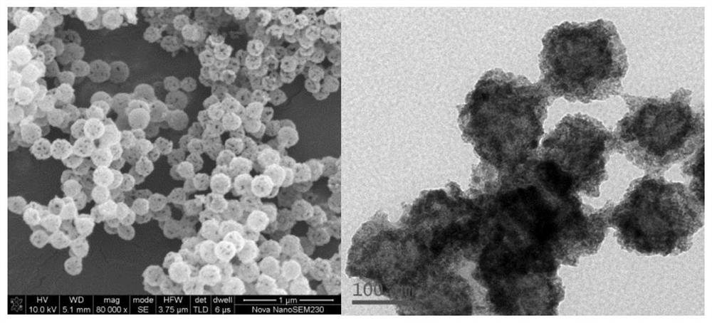 Medical double-shell porous structure hollow nanospheres and preparation method thereof