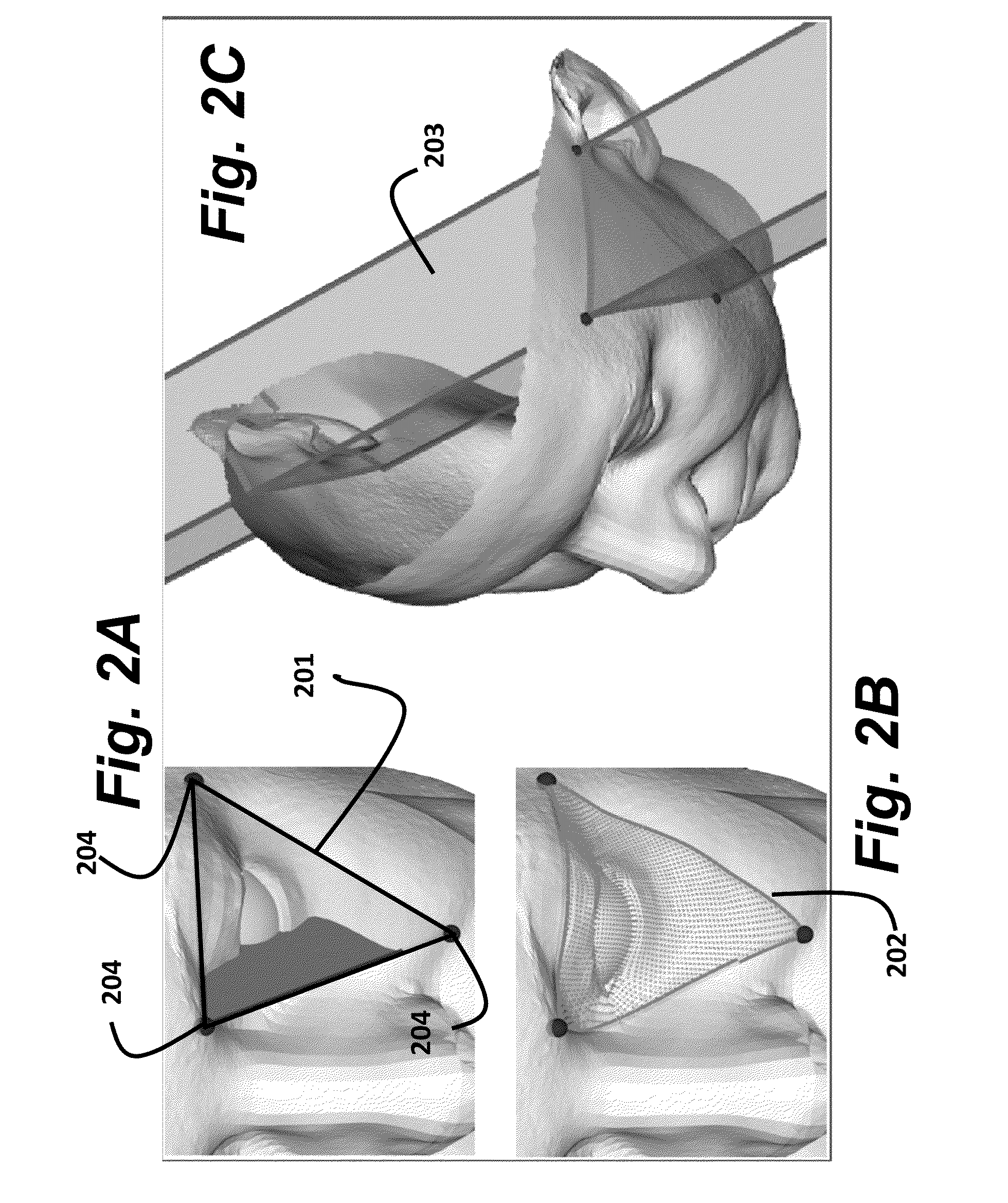 Method and System for Determining 3D Object Poses and Landmark Points using Surface Patches