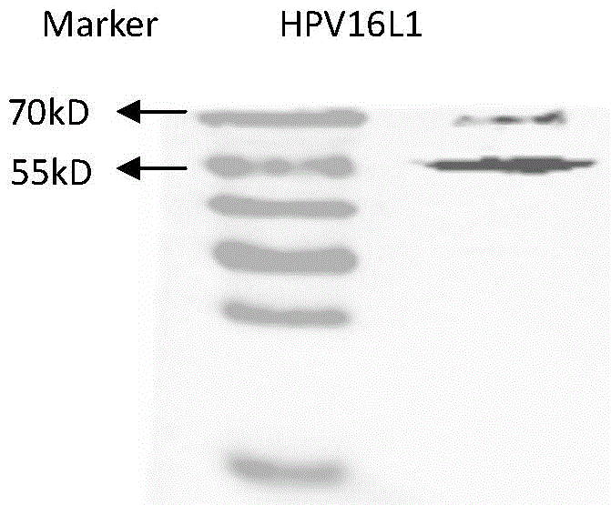 HPV16, 18L1 recombinant DNA vaccine for preventing and treating esophagus cancers