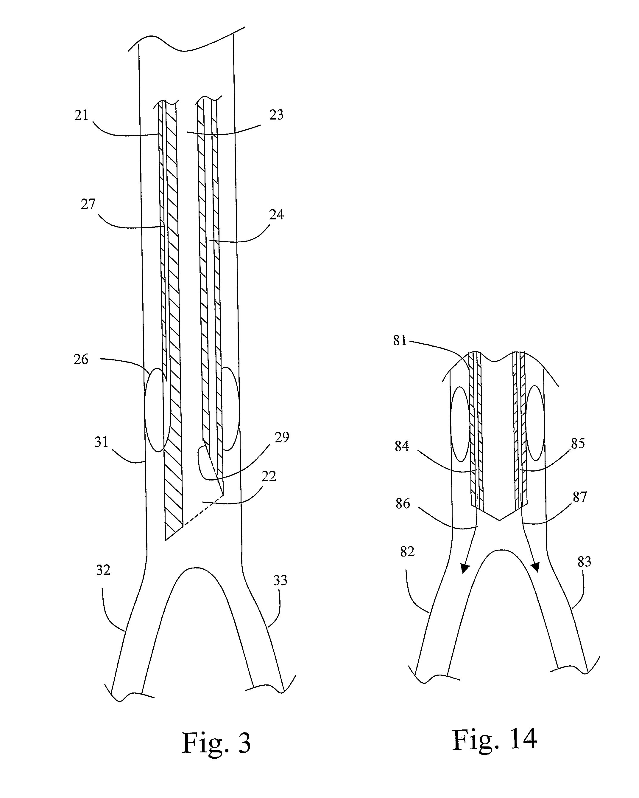 Method and device for gas supply during cardiopulmonary resuscitation