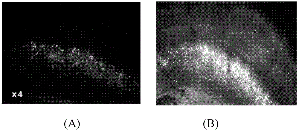 Optical clearing agent for bone tissue