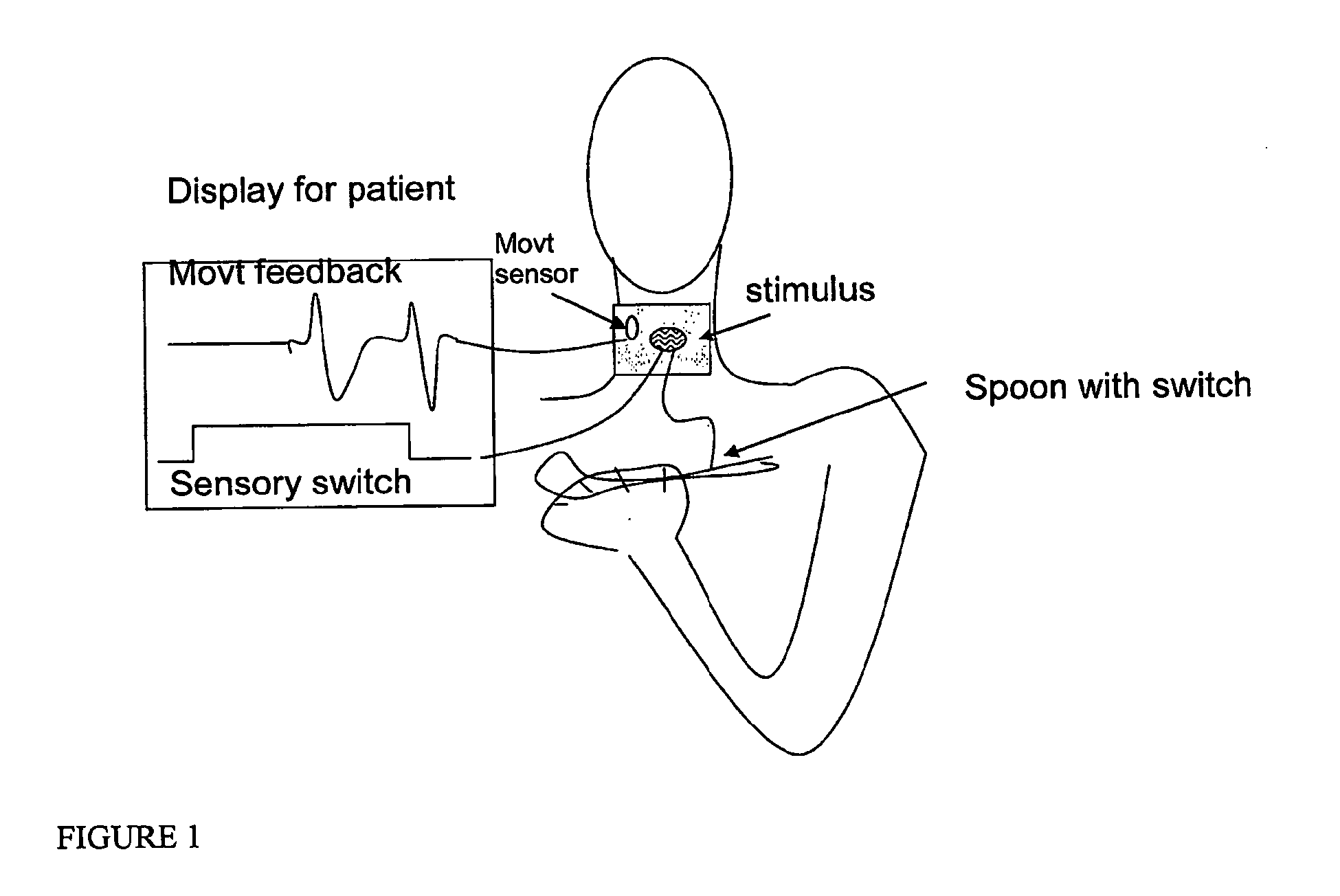 Systems for recovery from motor control via stimulation to a substituted site to an affected area