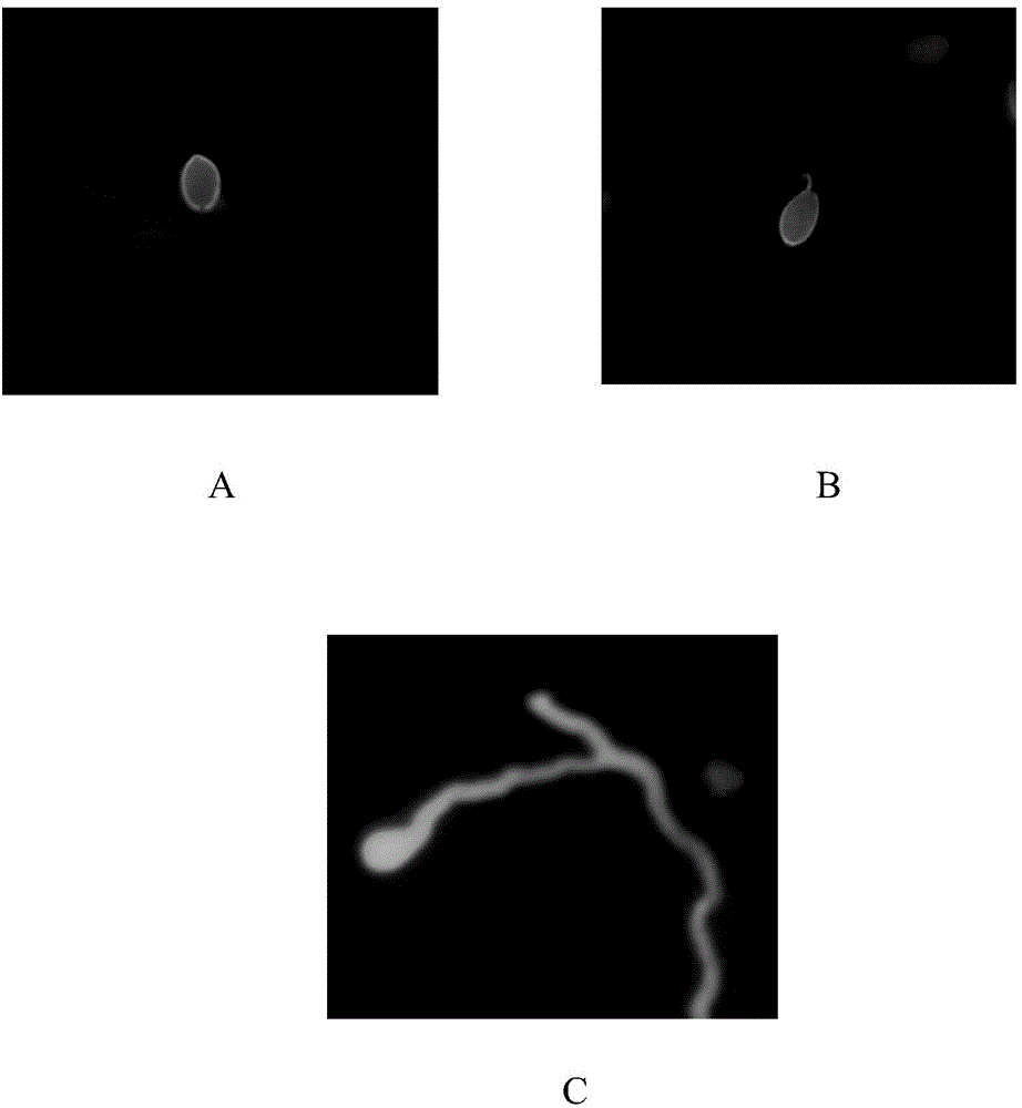 Fungus fluorescence staining method and application thereof