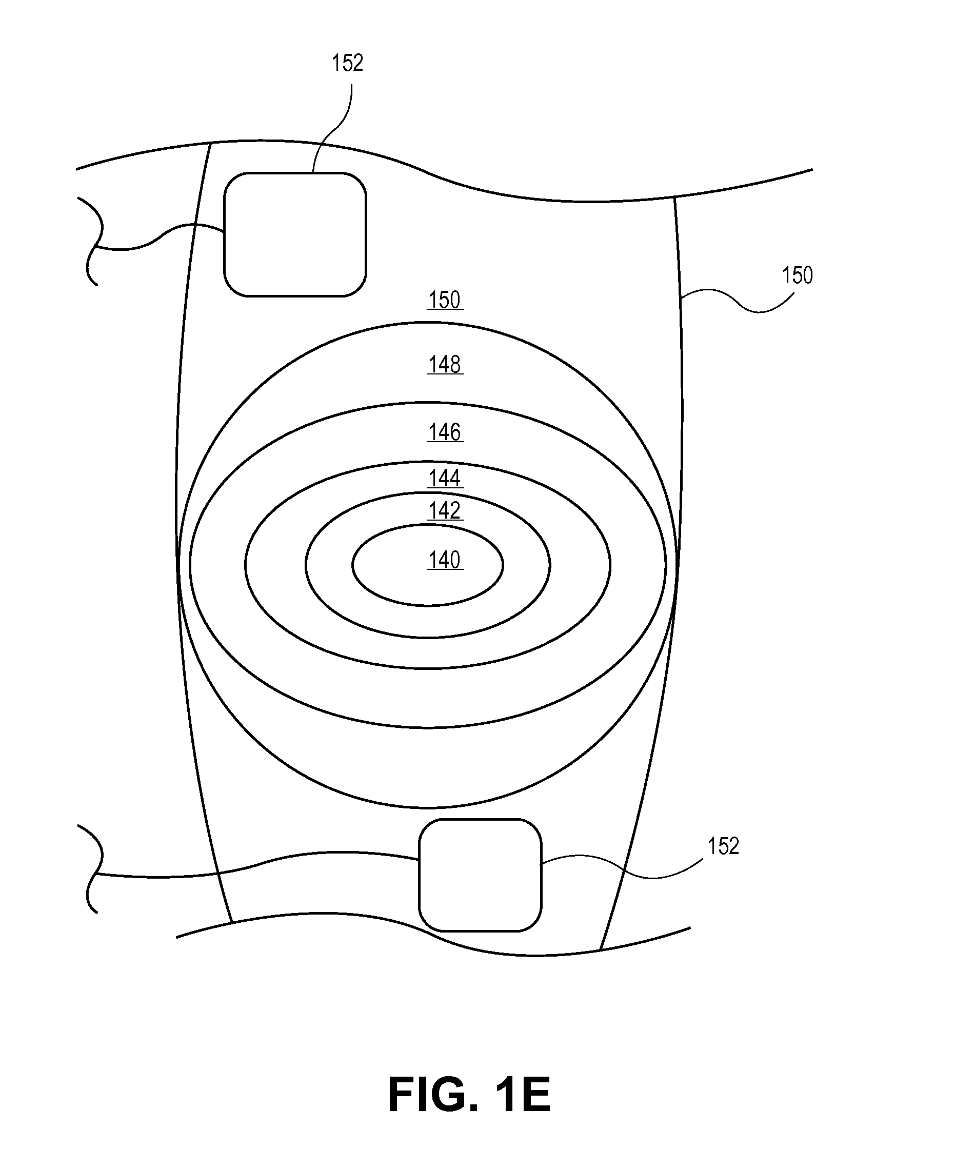 Devices and Systems for Stimulation of Tissues