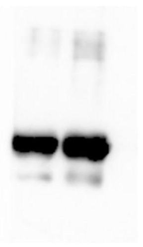 A gene encoding porcine circovirus type 2 cap protein and its application