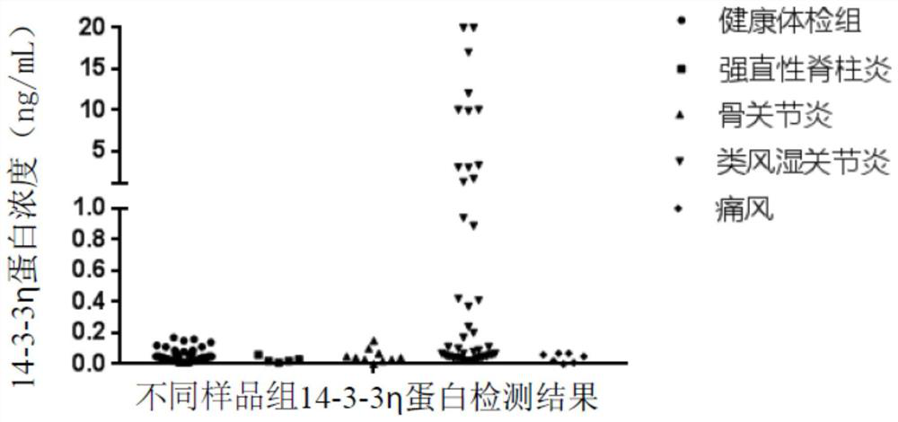 Homogeneous immunodetection kit for detecting 14-3-3eta protein and application of homogeneous immunodetection kit