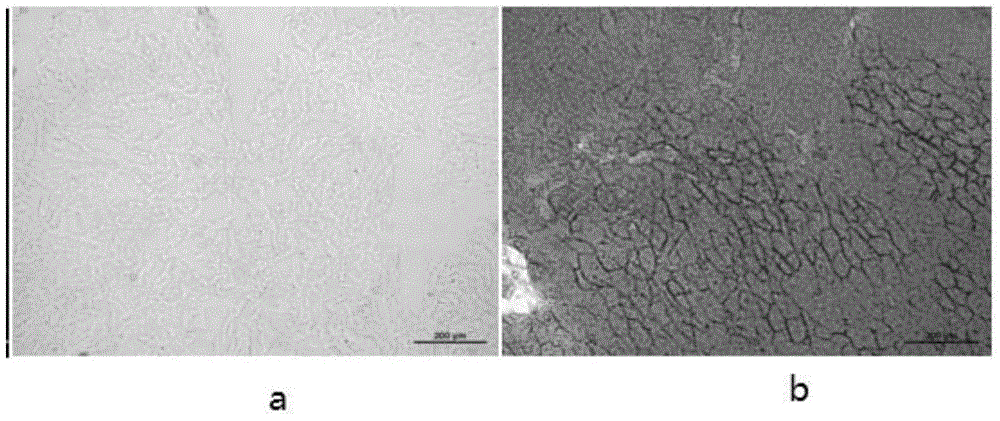 Preparation method of cell matrix-free material for porcine adipose tissue