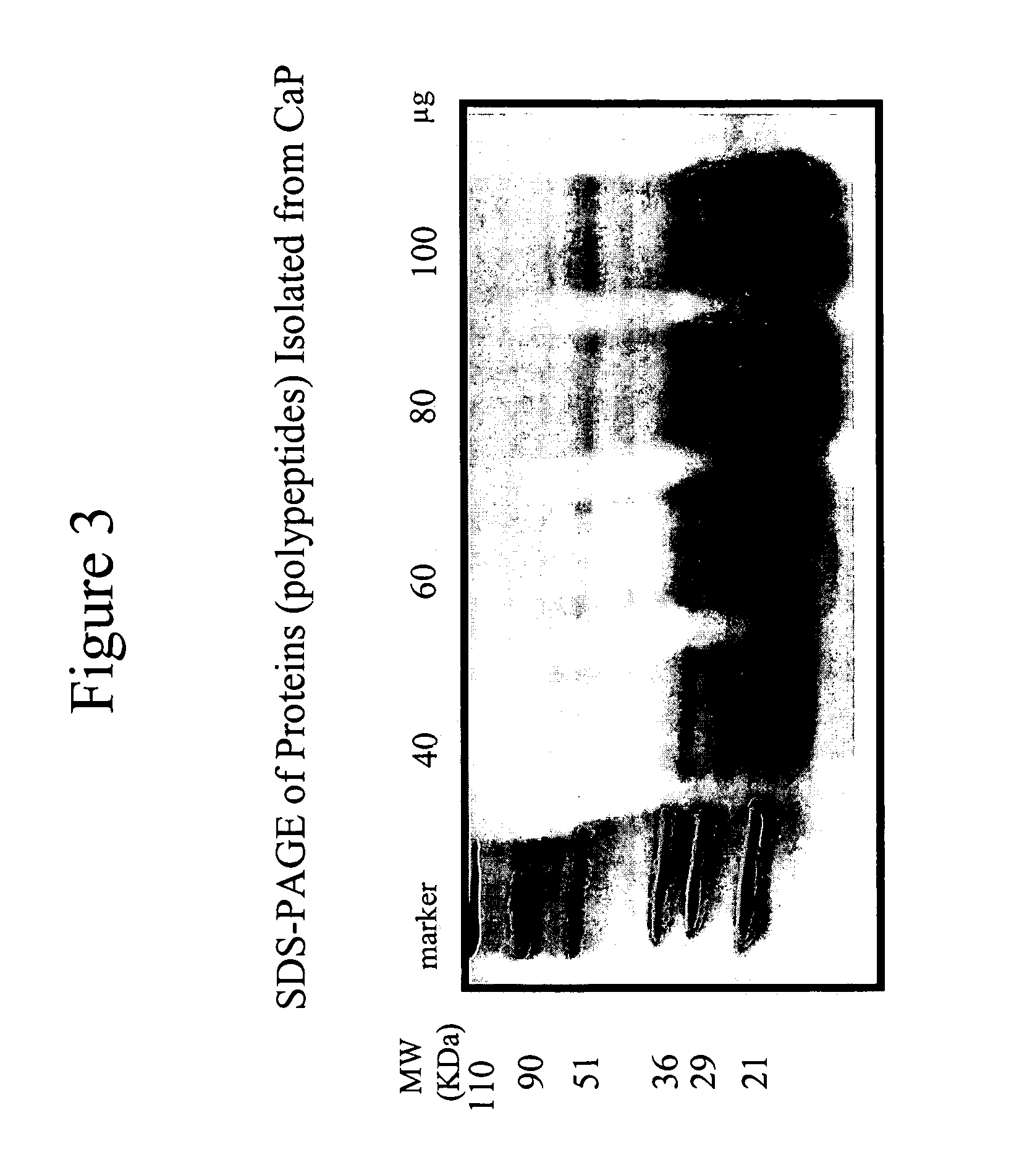 Connective tissue derived polypeptides