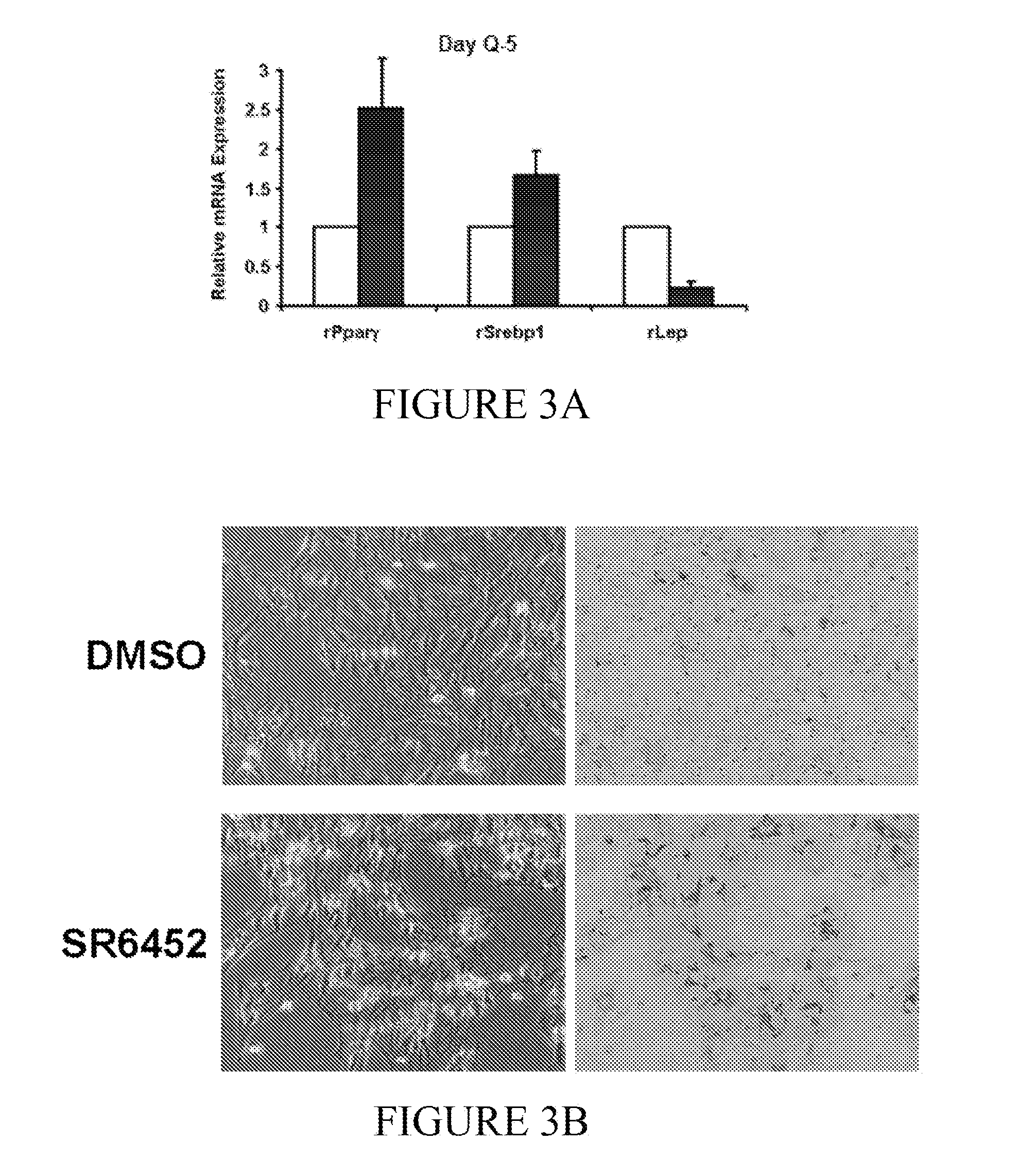 Methods of Treating Portal Hypertension