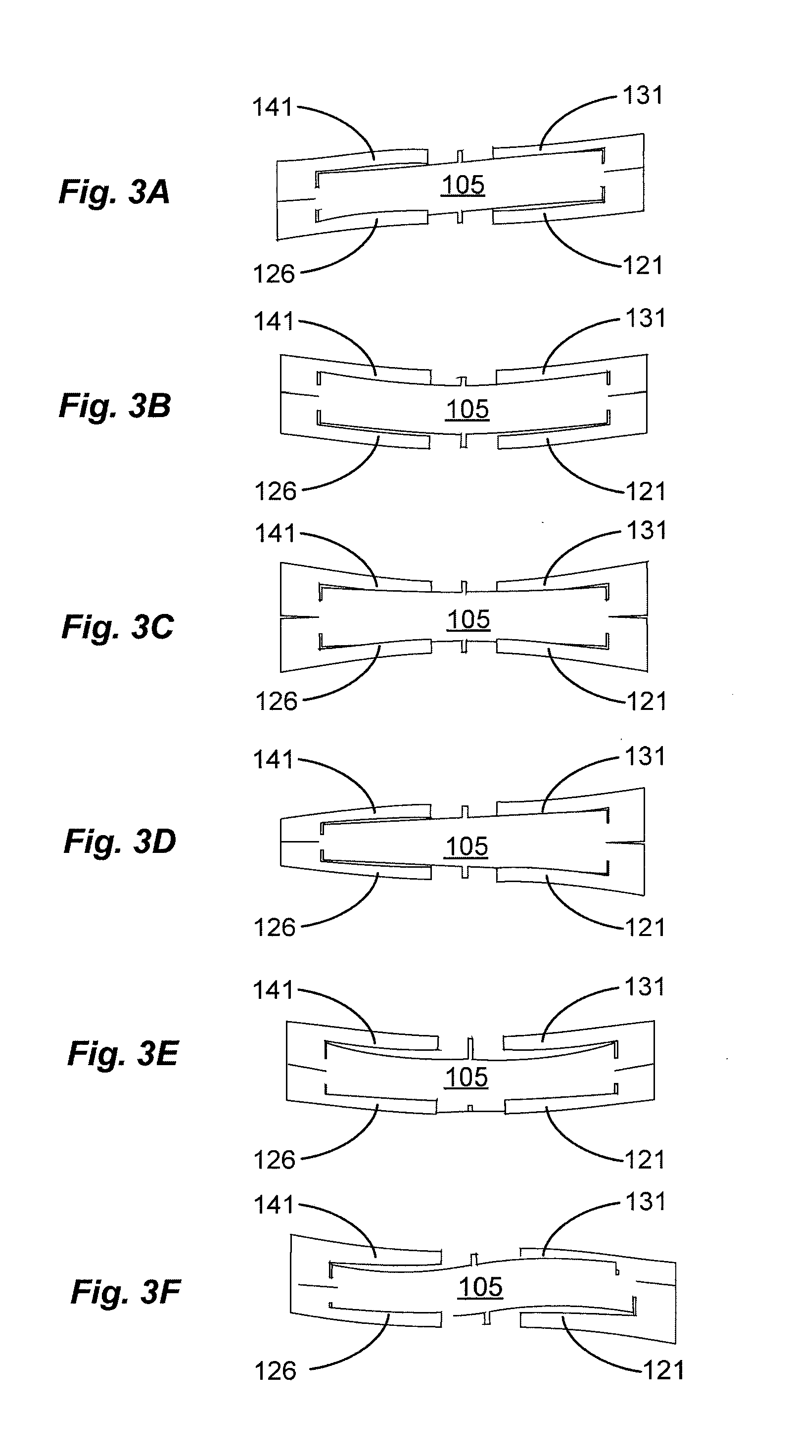 Acoustic sensor