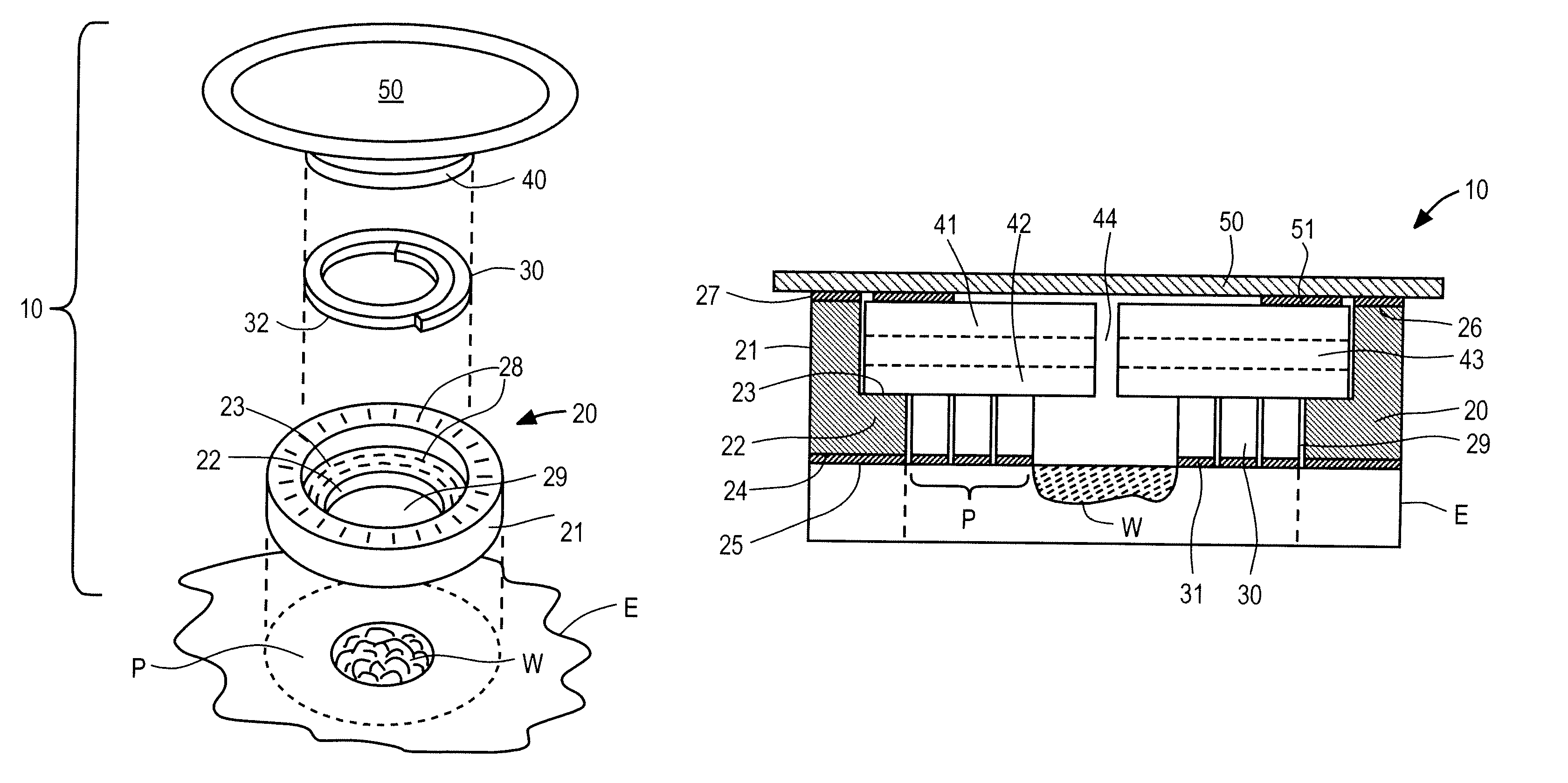 Systems and methods for wound protection and exudate management