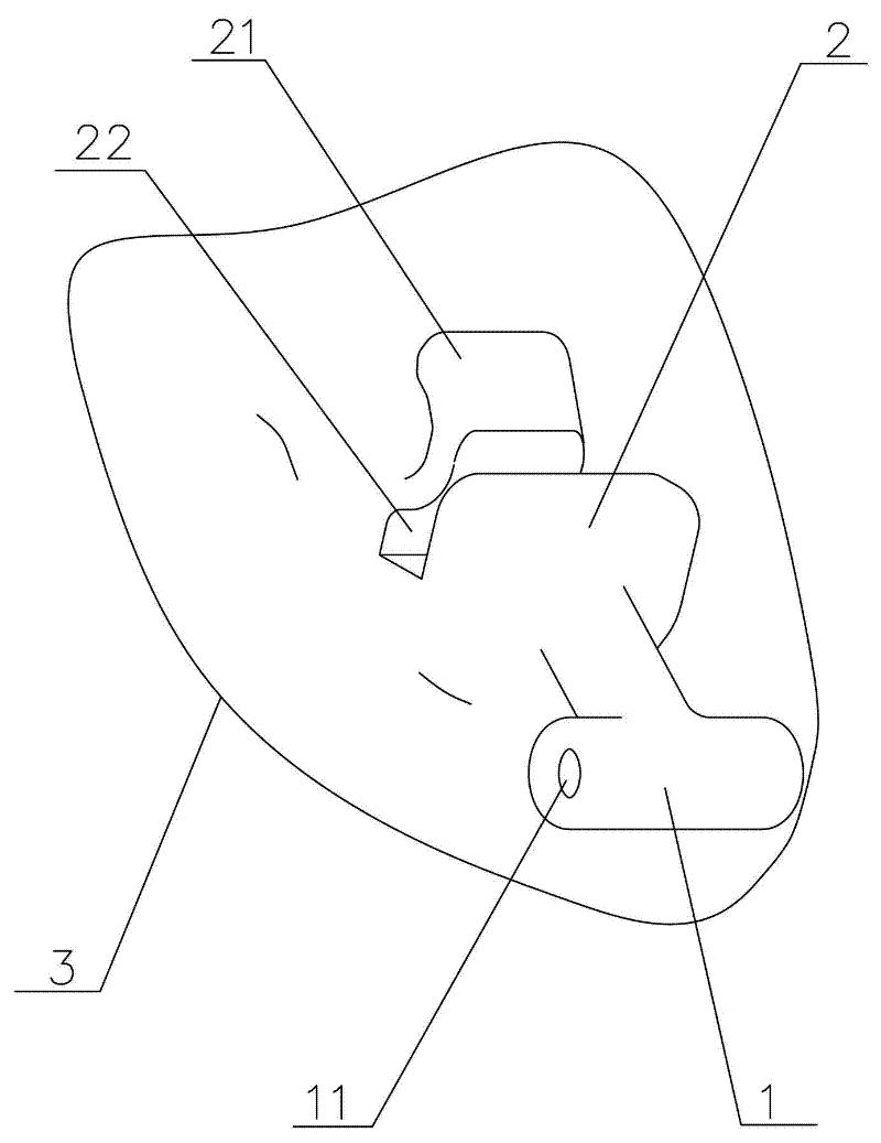 Personalized orthodontic appliance having orthoaxis function