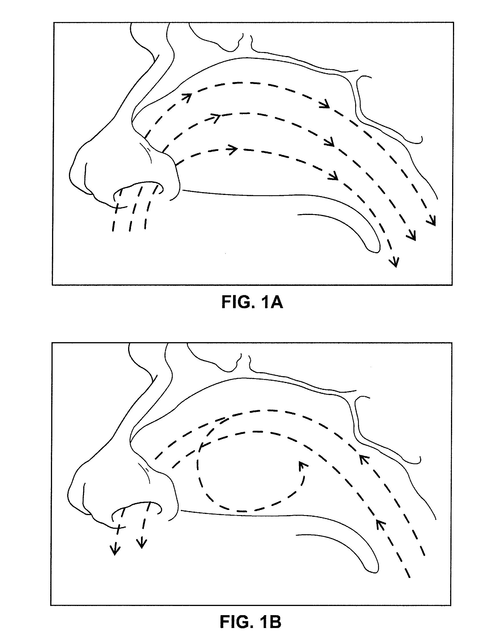 Nasal Device Useful for Prevention of Snoring and Sleeping Apnea