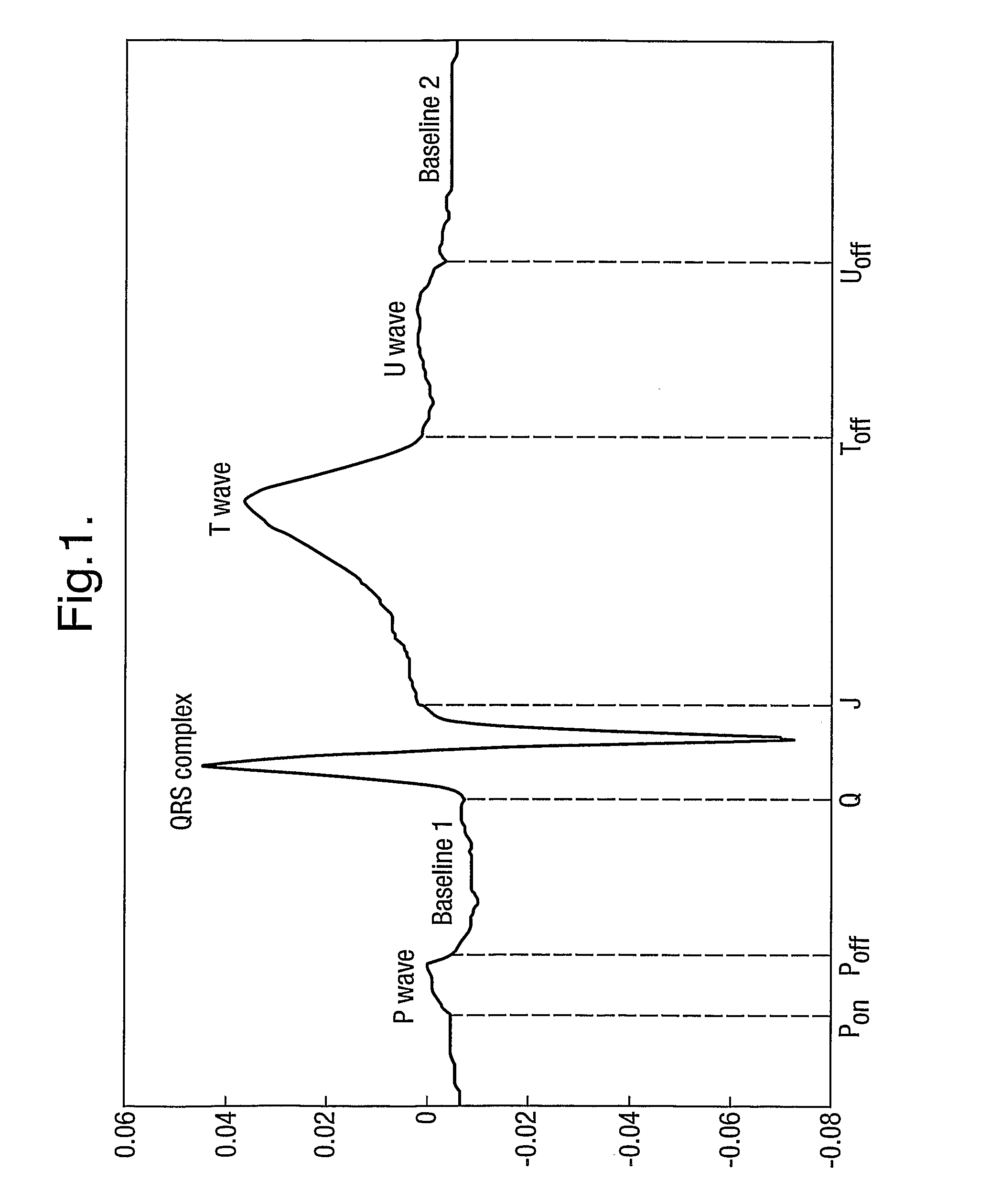 Method of biomedical signal analysis including improved automatic segmentation