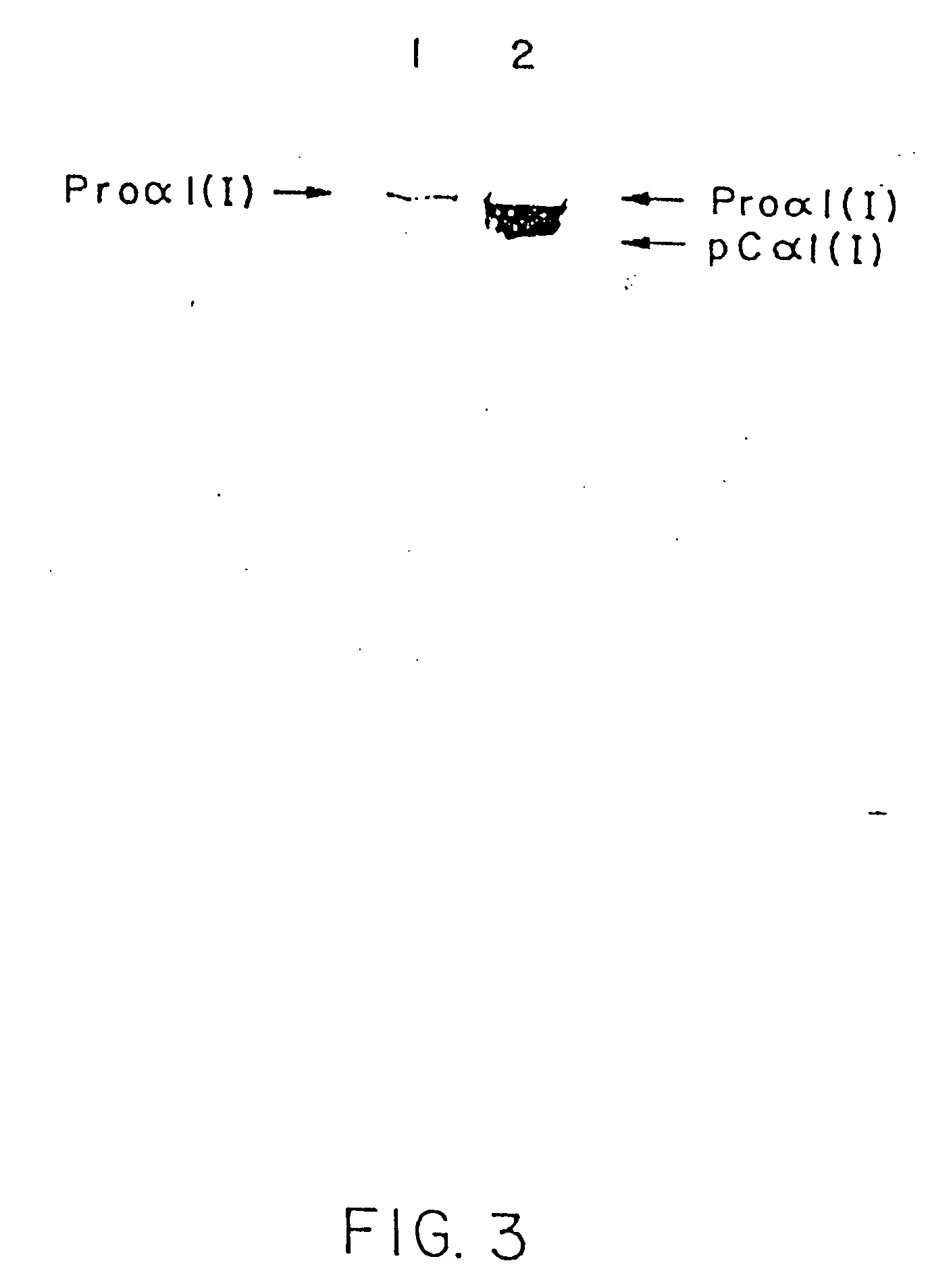 Synthesis of human procollagens and collagens in recombinant DNA systems