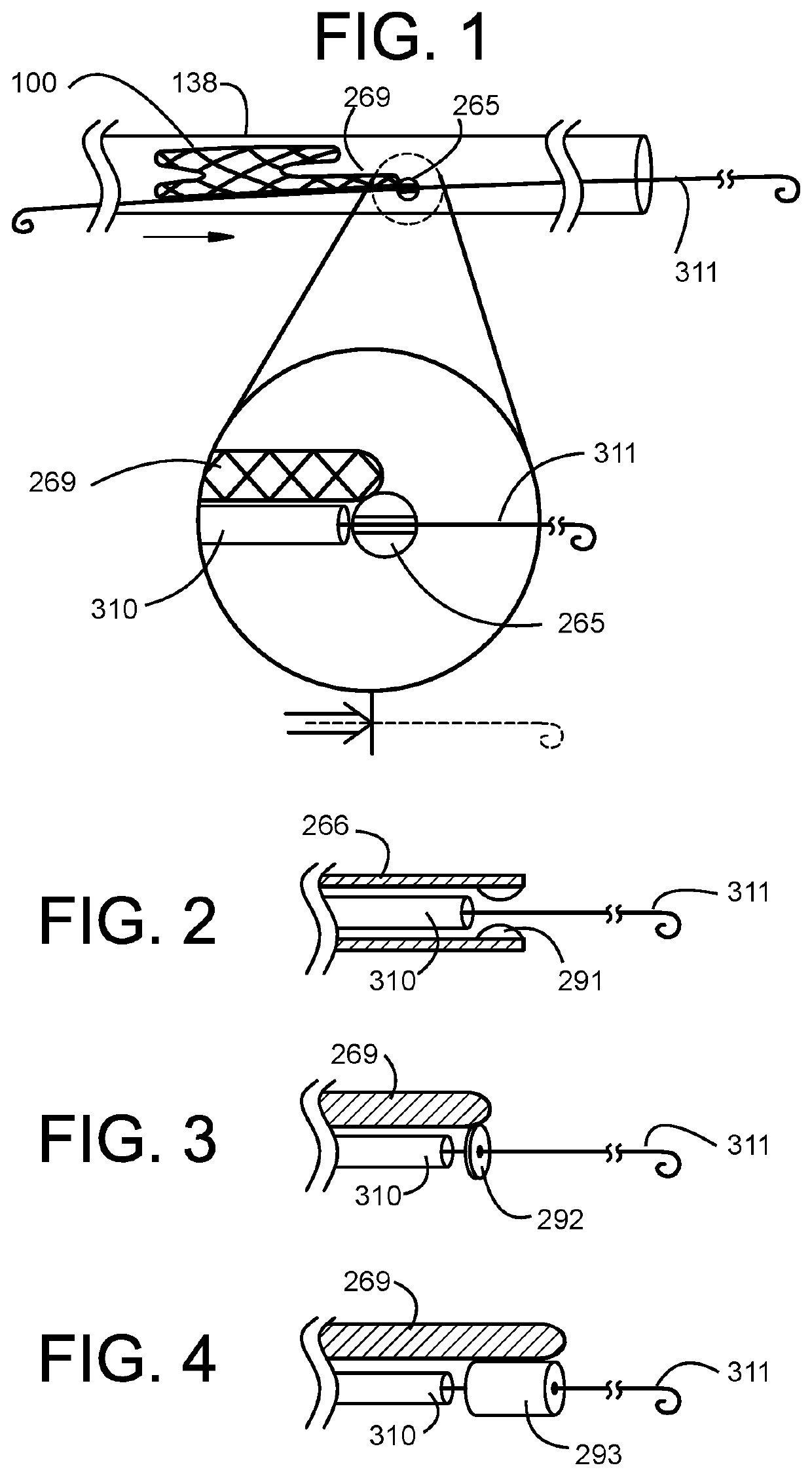 Guidewire Delivery of Transcatheter Heart Valve