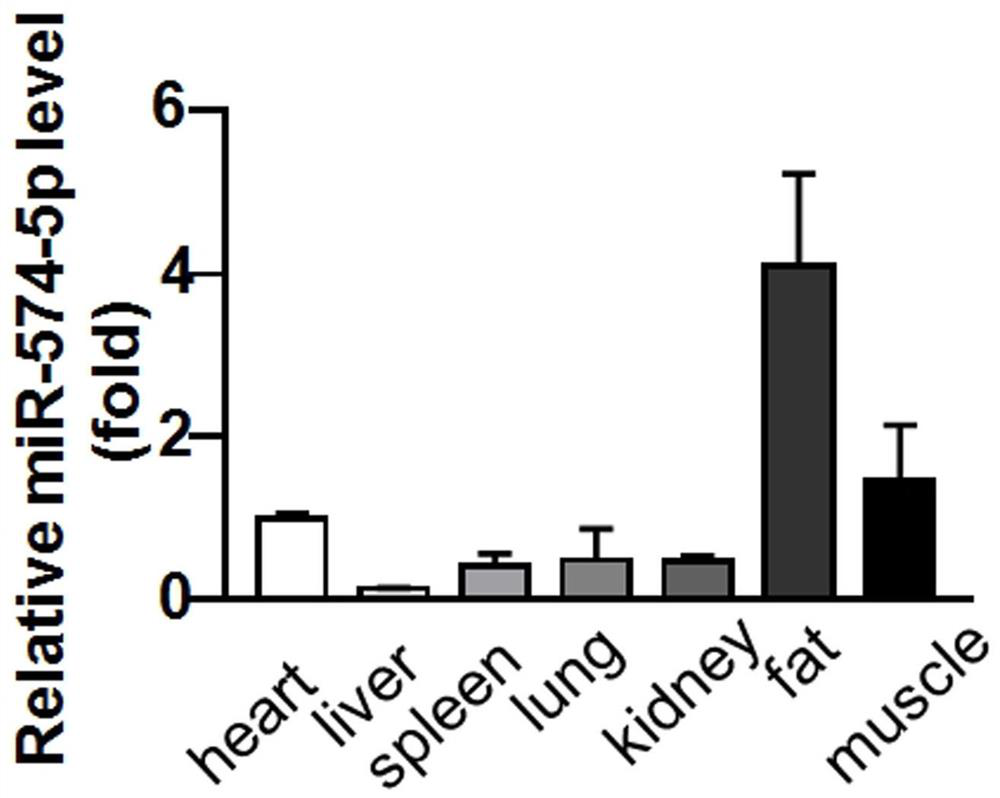 The medical application of mir-574-5p in diabetes and related diseases