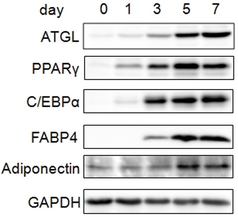 The medical application of mir-574-5p in diabetes and related diseases