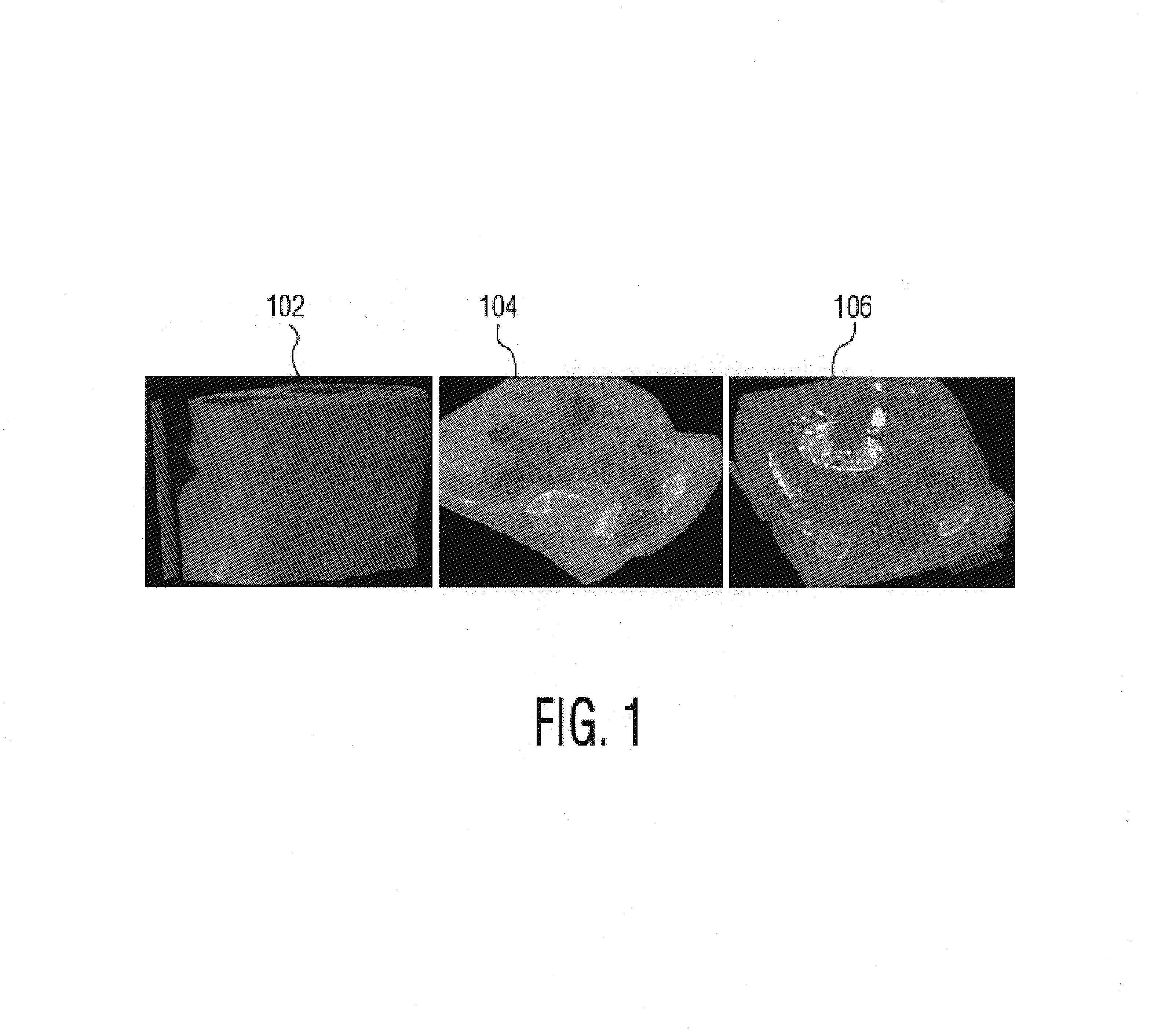 System and method for using learned discriminative models to segment three dimensional colon image data