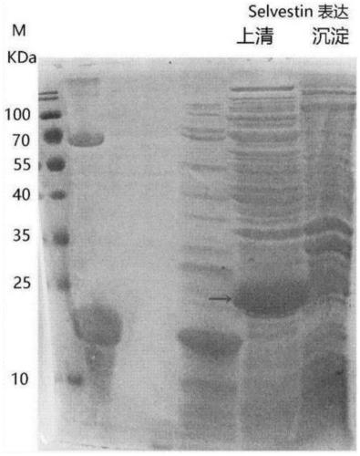 A kind of forest leech antithrombotic polypeptide sylvestin and its in vitro expression preparation method and application