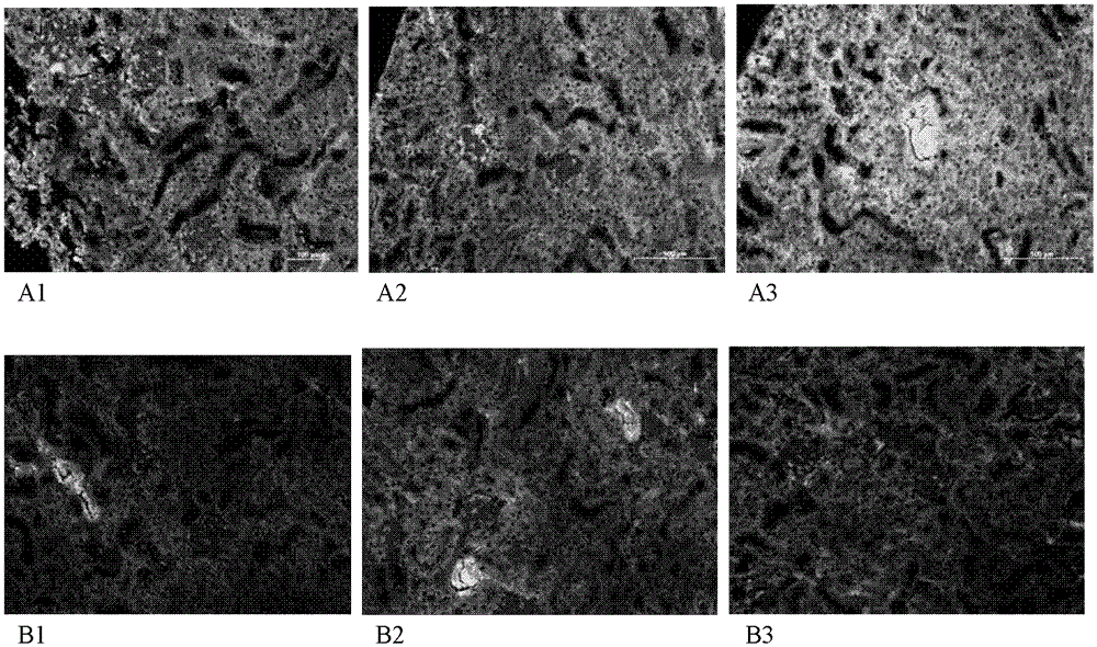 Use of vanillic acid derivatives in the treatment of systemic autoimmune diseases