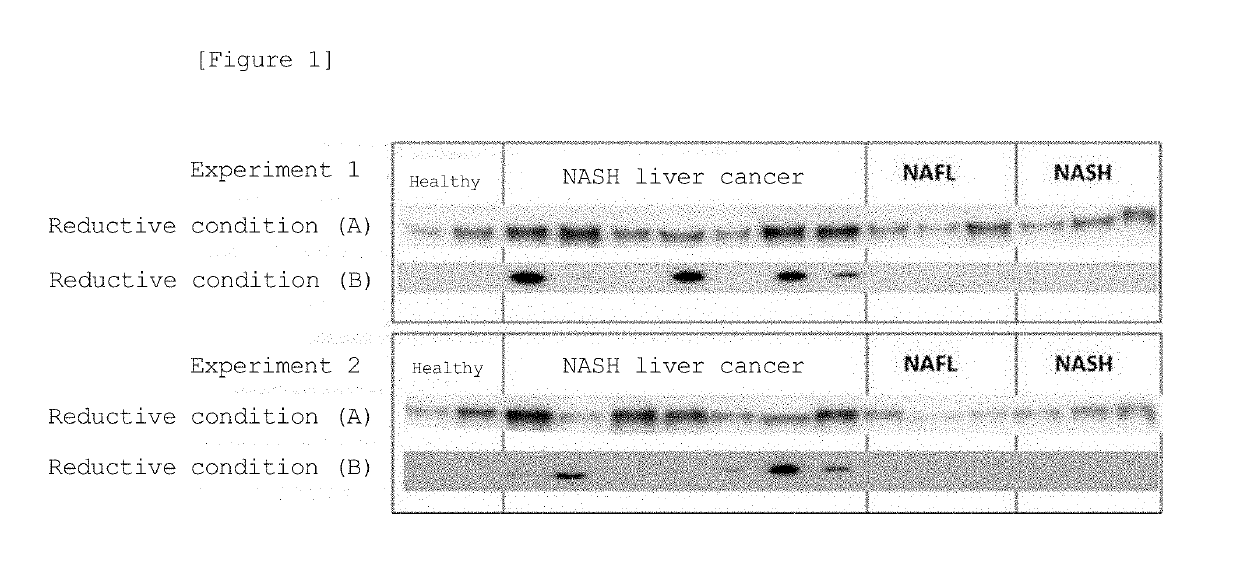 Method for examining liver cancer