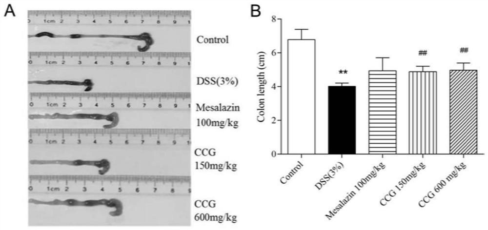 Application of radix crotonis crassifolii extract in preparation of medicine for preventing and/or treating ulcerative colitis