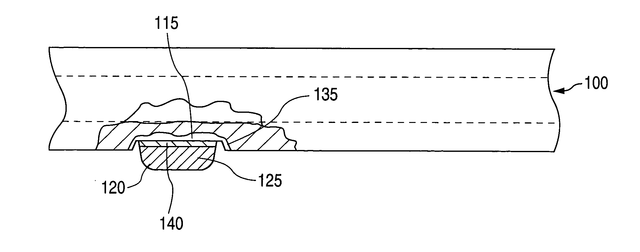 Porous glass fused onto stent for drug retention