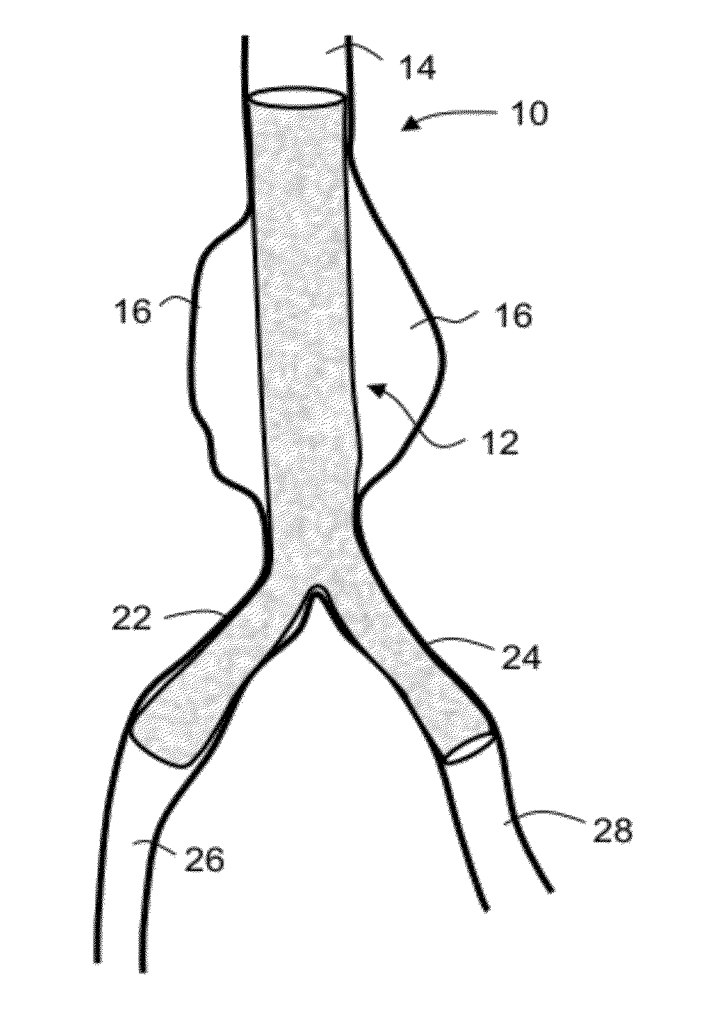 Intraluminal polymeric devices for the treatment of aneurysms