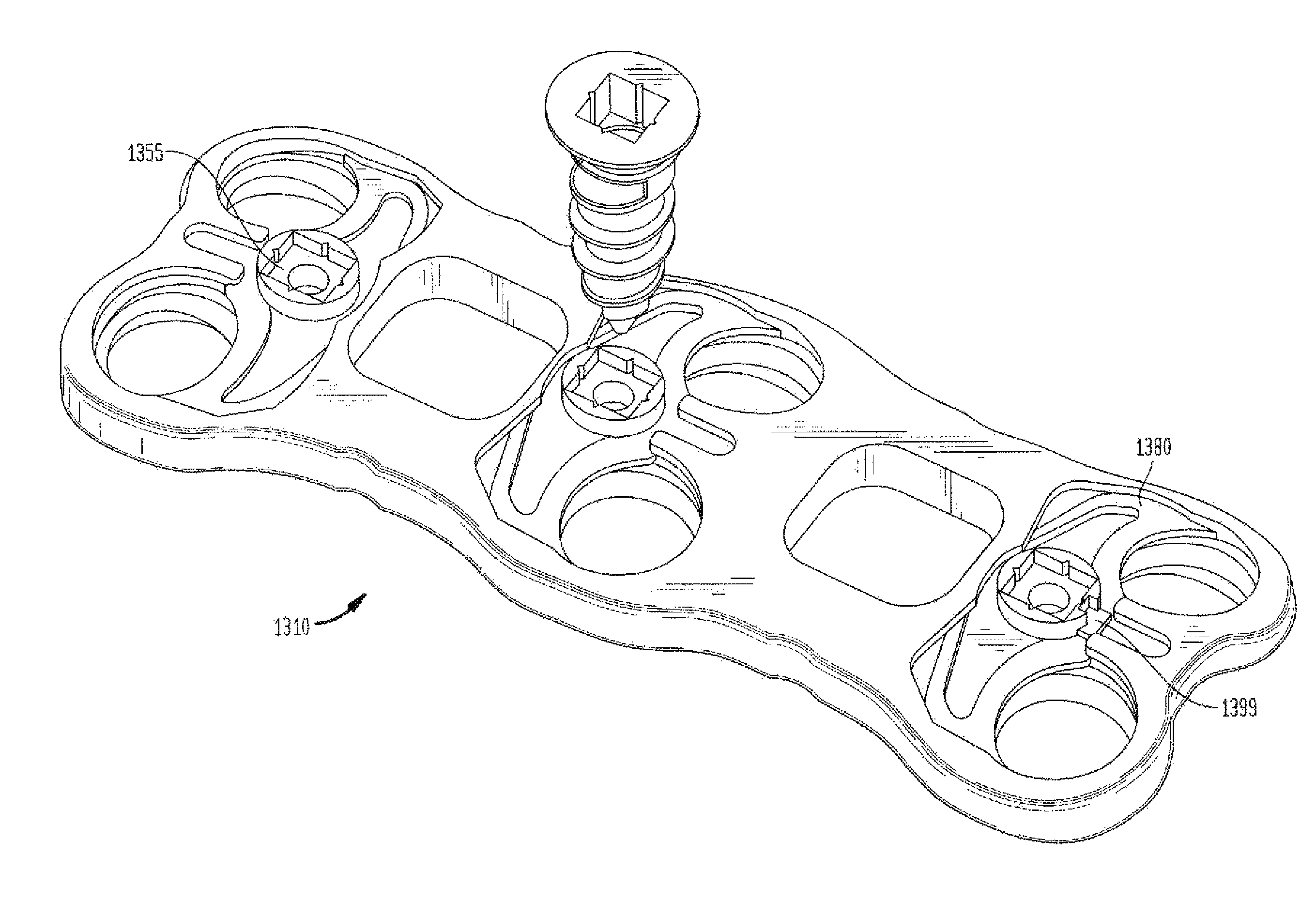 Cervical plate with a feedback device for selective association with bone screw blocking mechanism