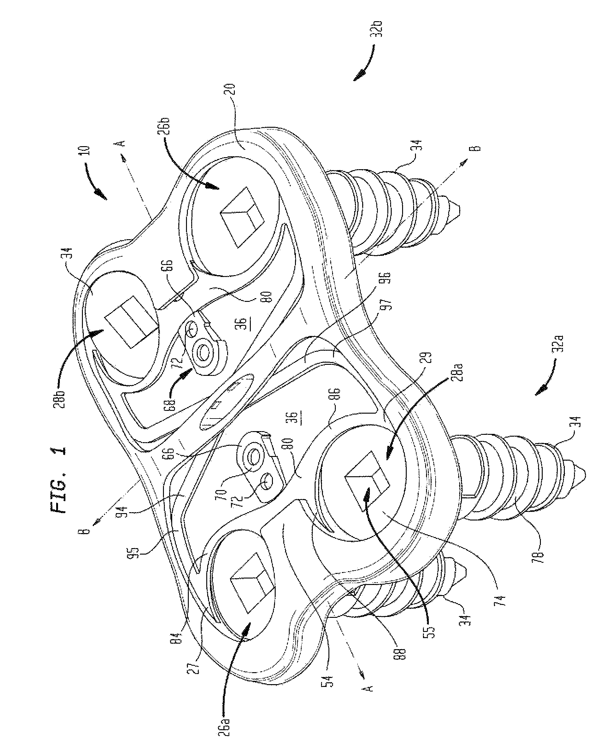 Cervical plate with a feedback device for selective association with bone screw blocking mechanism