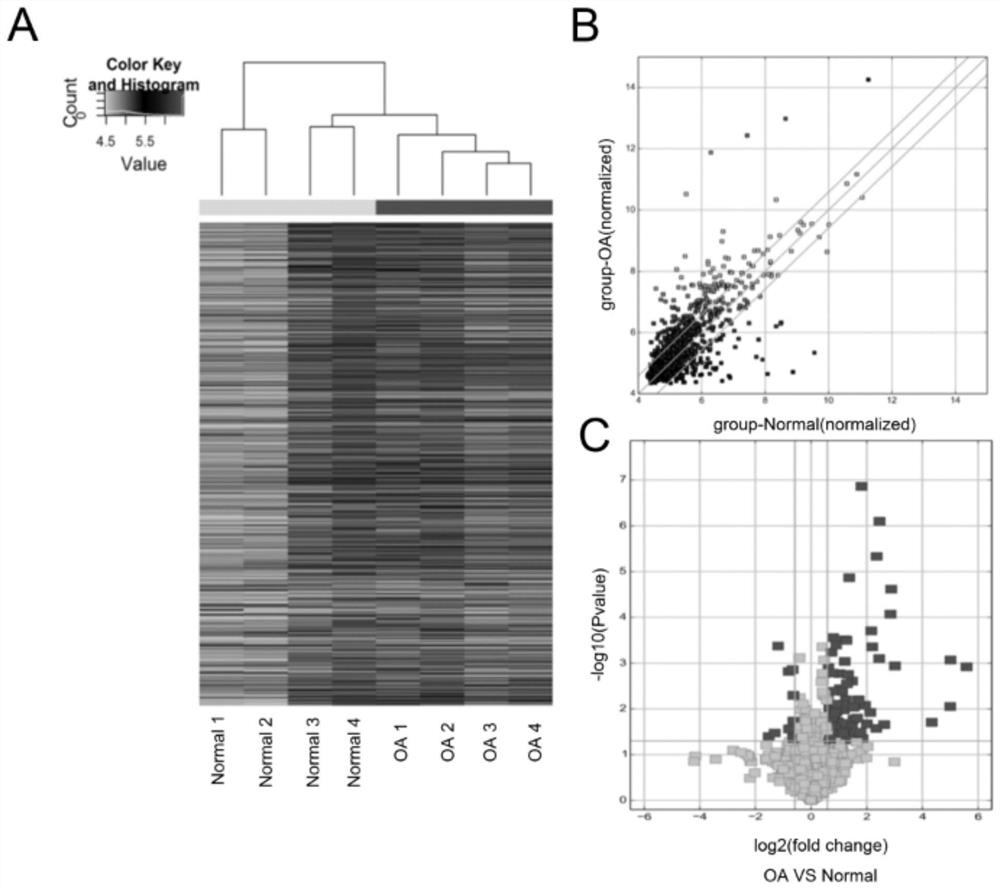 Application of circular RNA as osteoarthritis marker