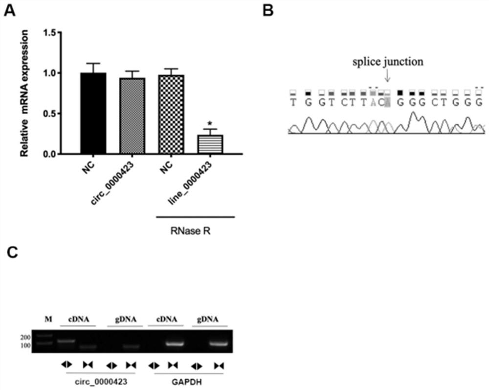 Application of circular RNA as osteoarthritis marker