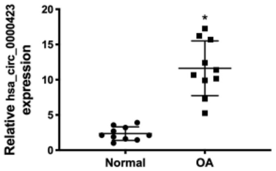 Application of circular RNA as osteoarthritis marker